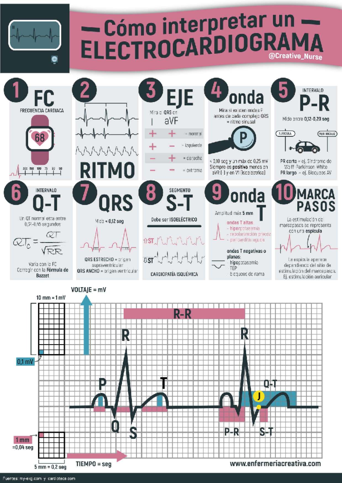 Interpretación del Electrocardiograma - ECG 101 - Studocu