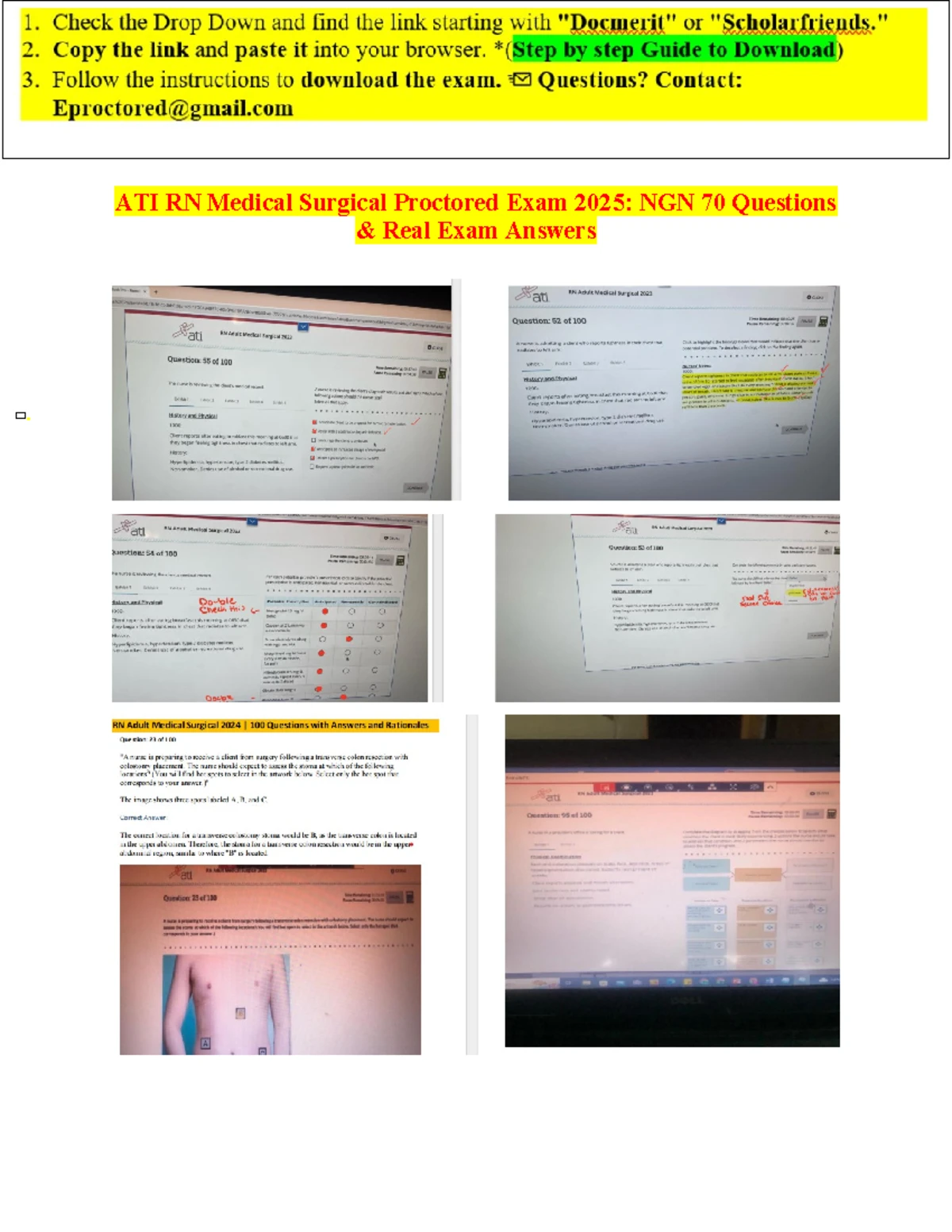 Exclusive ATI TEAS 7 All Subjects Full 2025 Exam Bundle (2023-2025) 100 ...