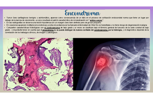 3. Condrosarcoma - Descripcion de patologias radiologicas ...