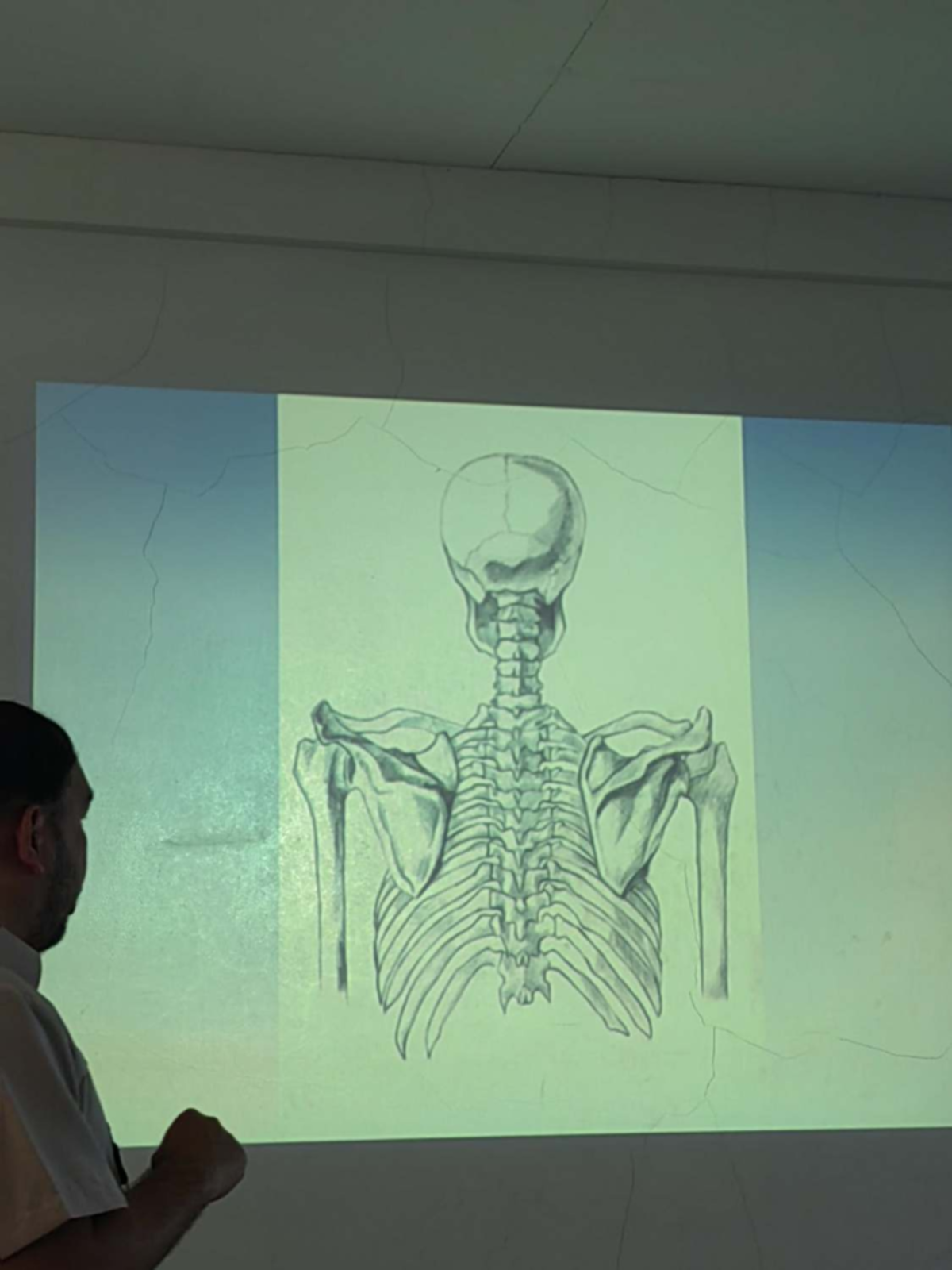 Anatomy Week 6: Functions and Shapes of Bones - Studocu