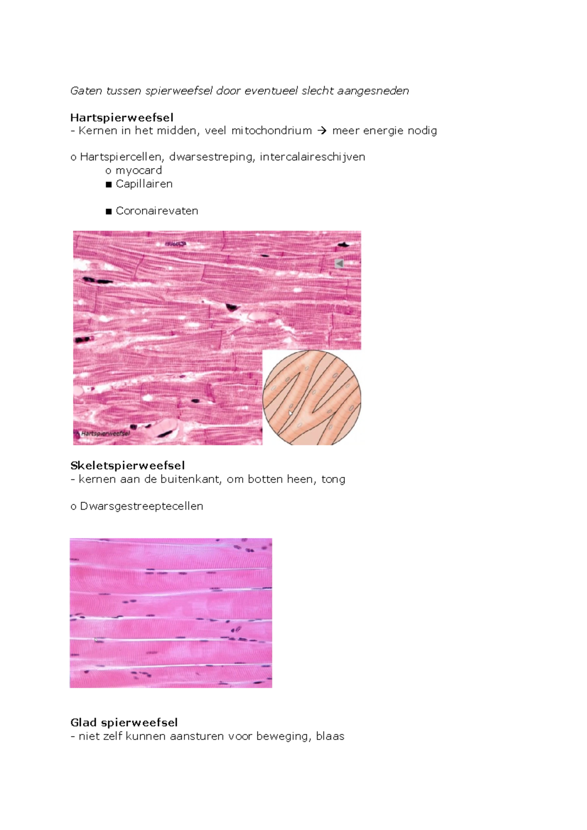 BLT pt 05 Spierweefsel: Hart-, Skelet- en Glad Weefsel Analyse ...
