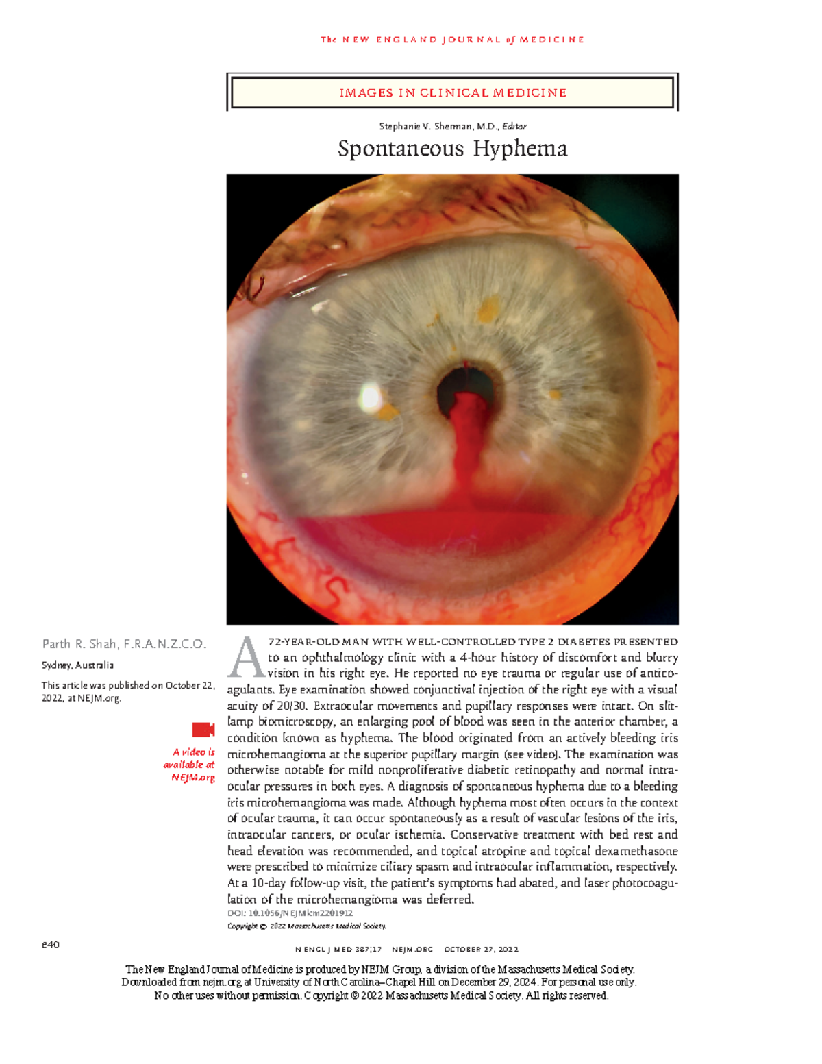 Spontaneous Hyphema Case Study - NEJM 2022 Publication - T h e n e w e ...