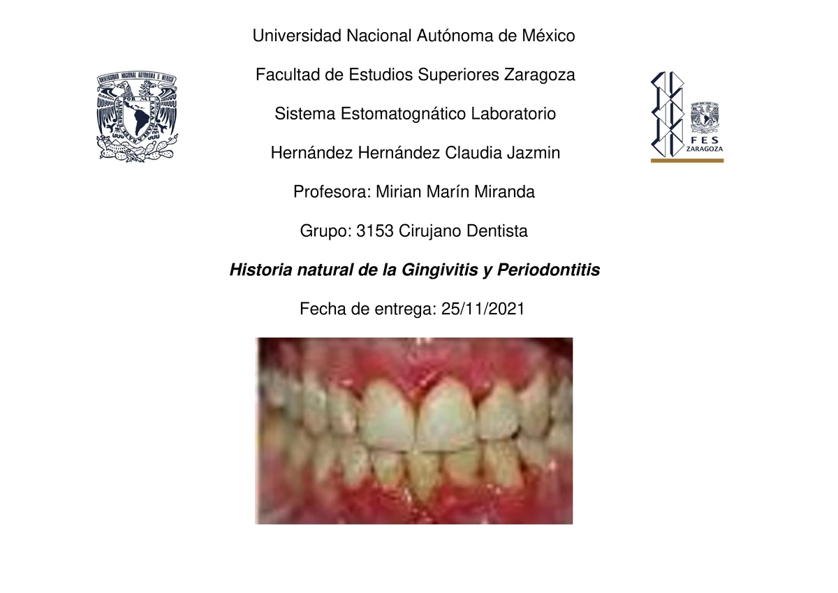 Anatomía dental (foseta, fisura, agujero, surco, fosa) - Alcantara ...
