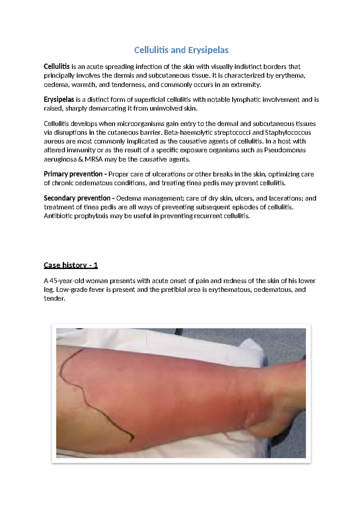 Cellulitis and Pilonidal Disease Study Notes - GC - Studocu