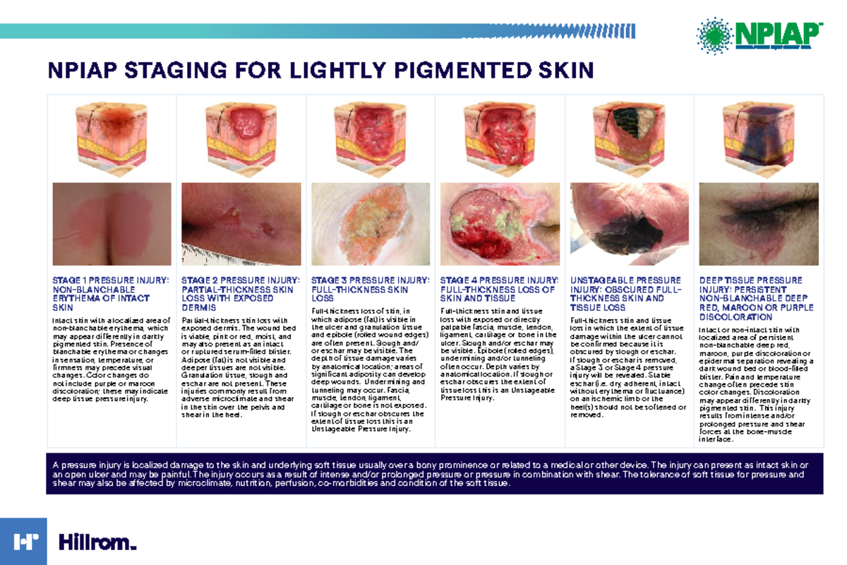 Npiap-Staging Card-LR - NPIAP STAGING FOR LIGHTLY PIGMENTED SKIN STAGE ...