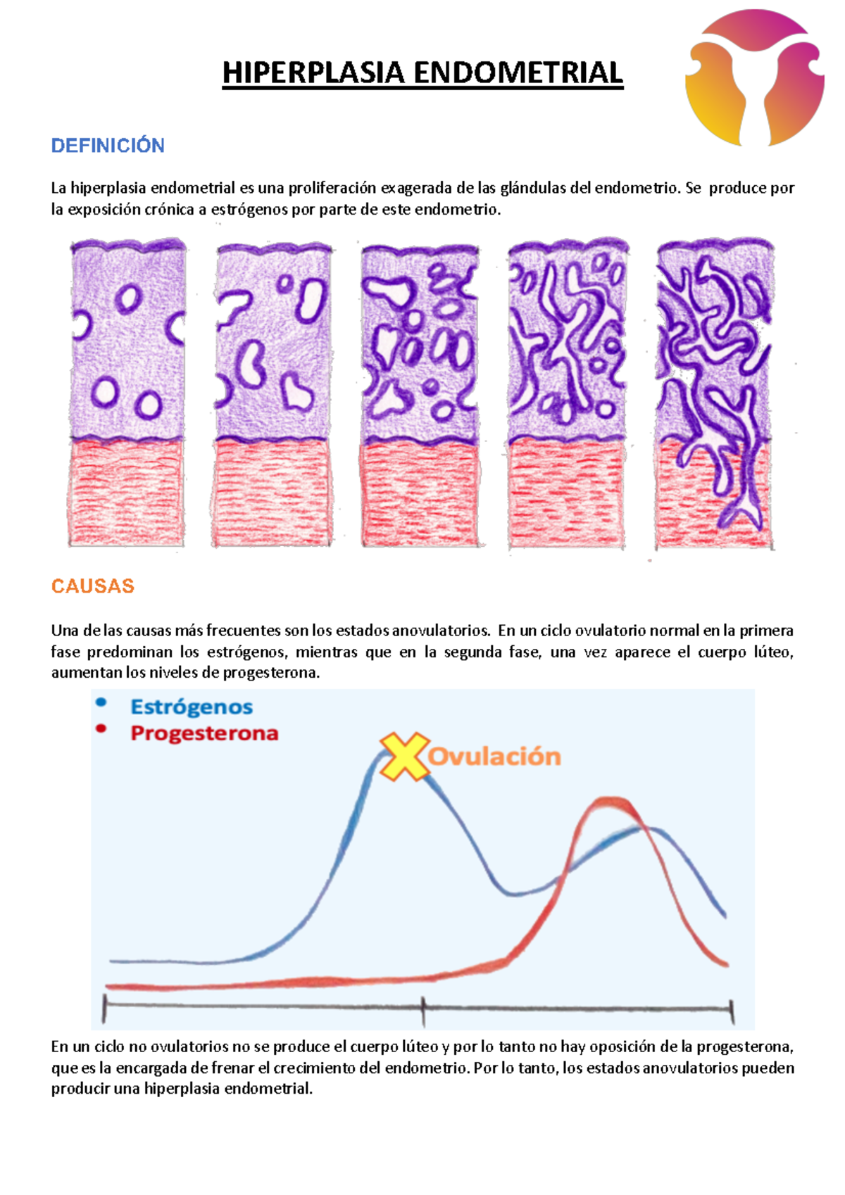 7-Hiperplasia-endometrial 240903 110457 - HIPERPLASIA ENDOMETRIAL ...