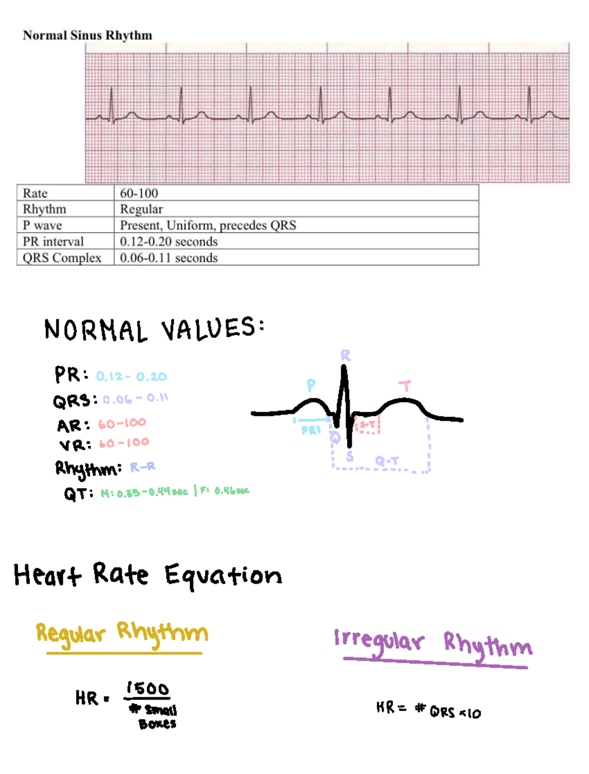 EKG - EKG - NUR3740 - NORMAL VALUES R PR 0 0. QRS 0 0. theft t Rhythm R ...