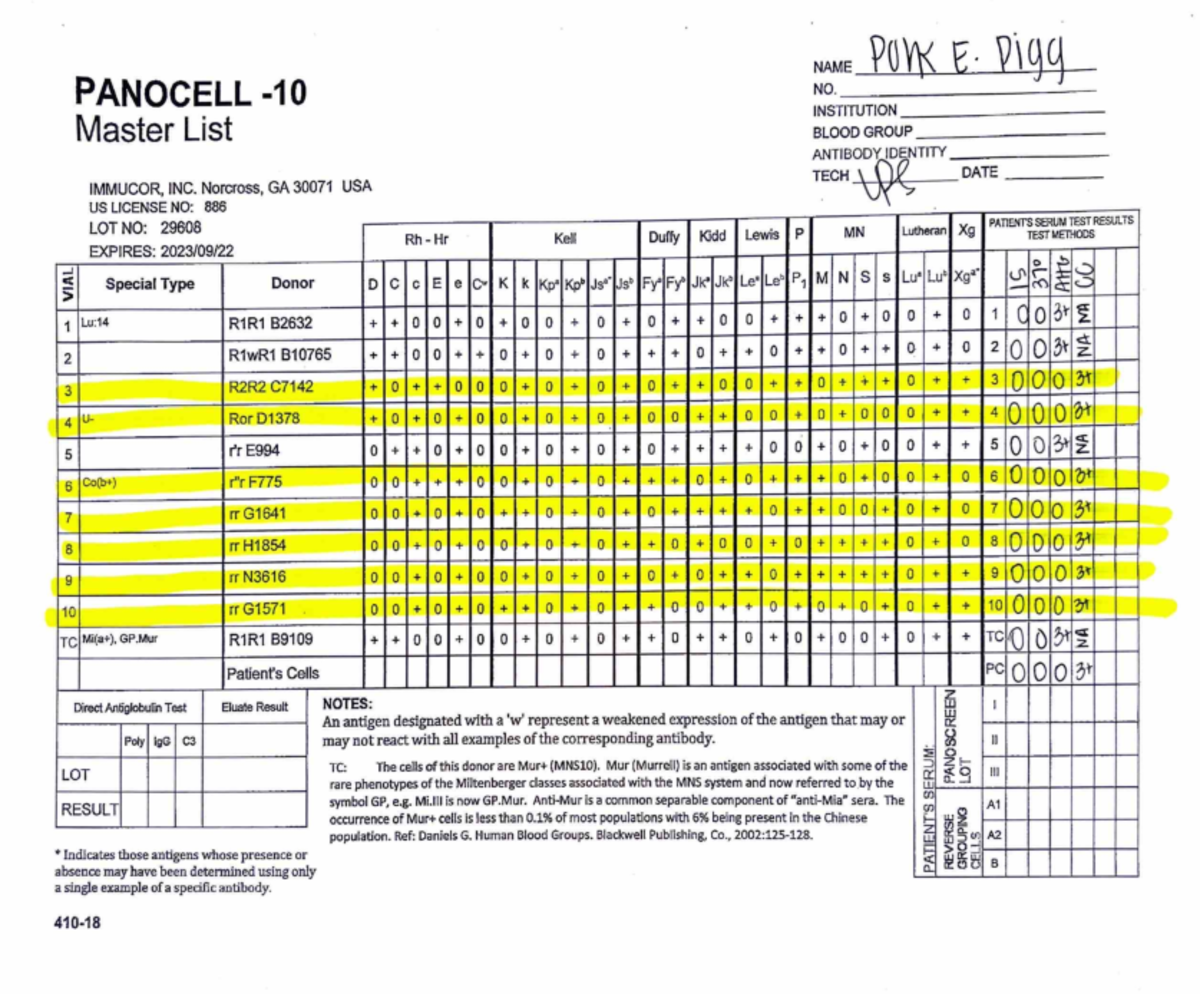 ABID Panel Master List: Detailed Blood Group Analysis - Studocu