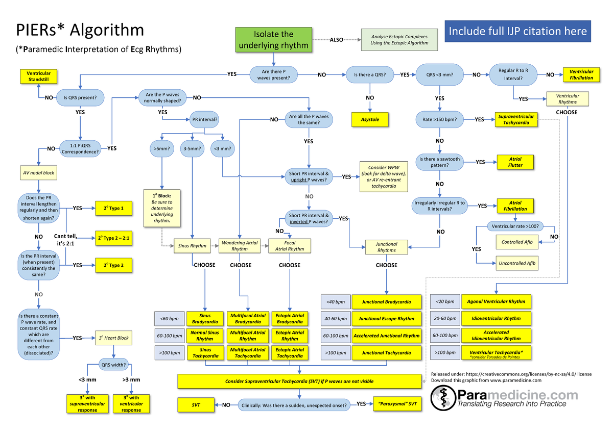 Piers Algorithm Detailed ECG Analysis Guide - ECG Help - Studocu