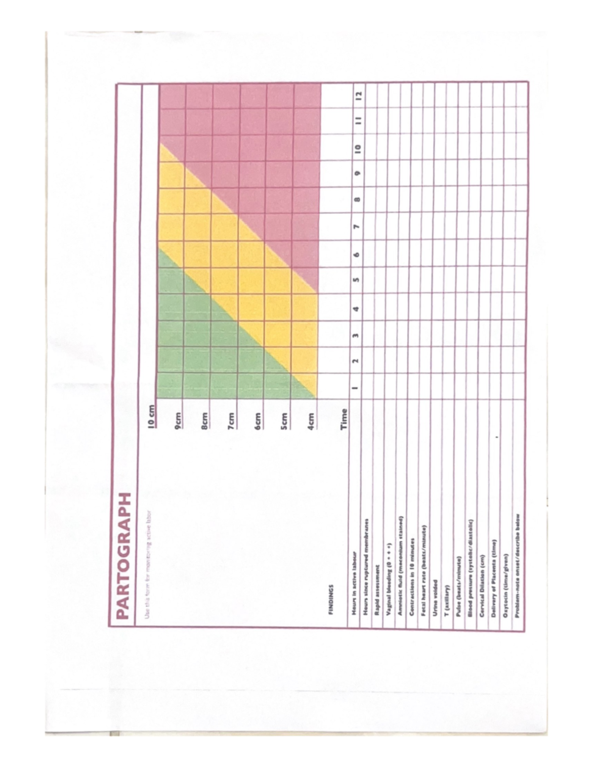 Partograph - parto - Bachelor of Science in Nursing - PARTOGRAPH Use ...