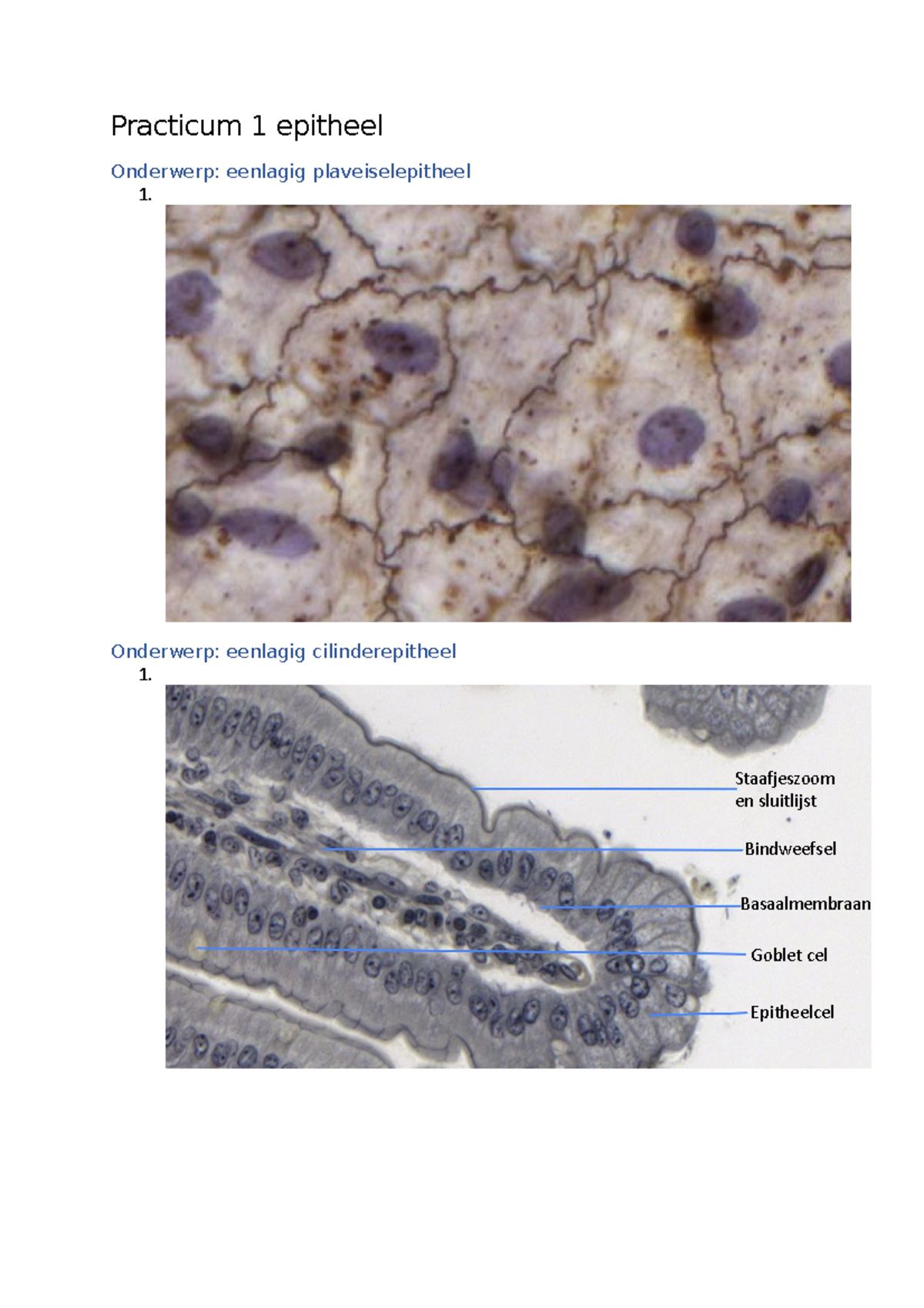 Practicum 1 Epitheel: Epitheliale Structuren en Metaplasie - Studeersnel