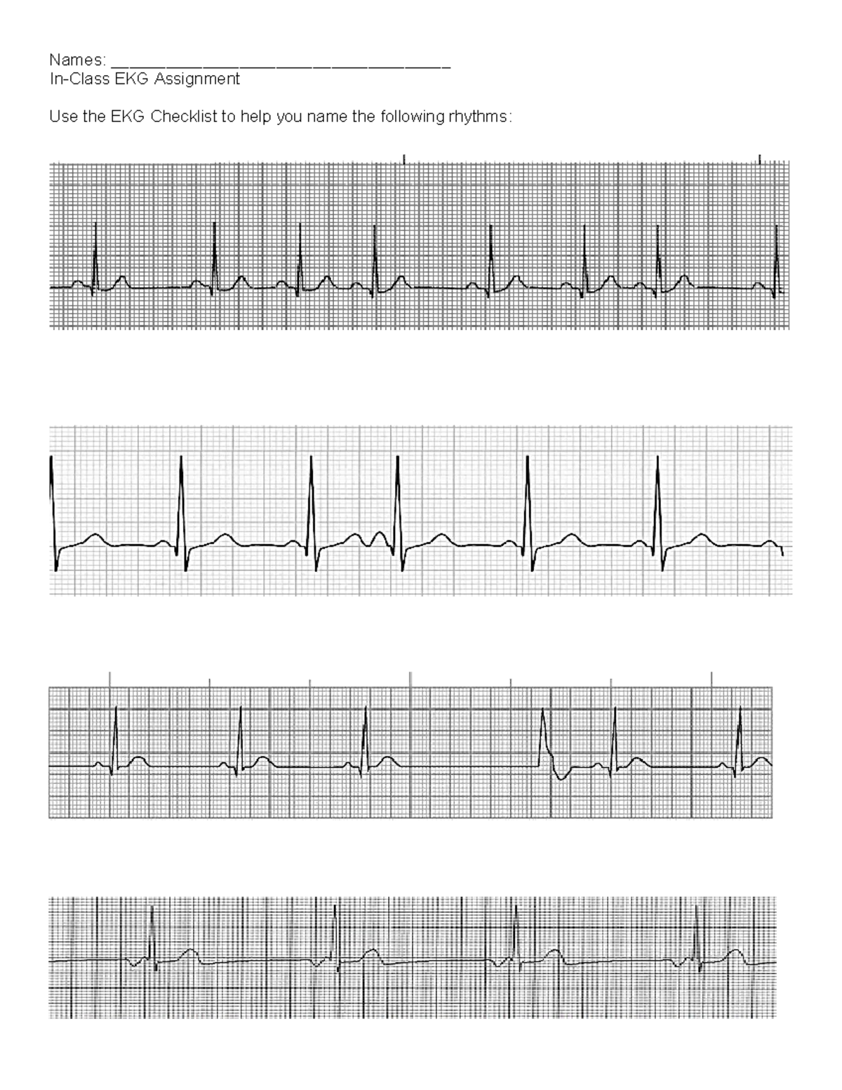 EKG Assignment: Rhythm Naming Practice with Answers - Studocu