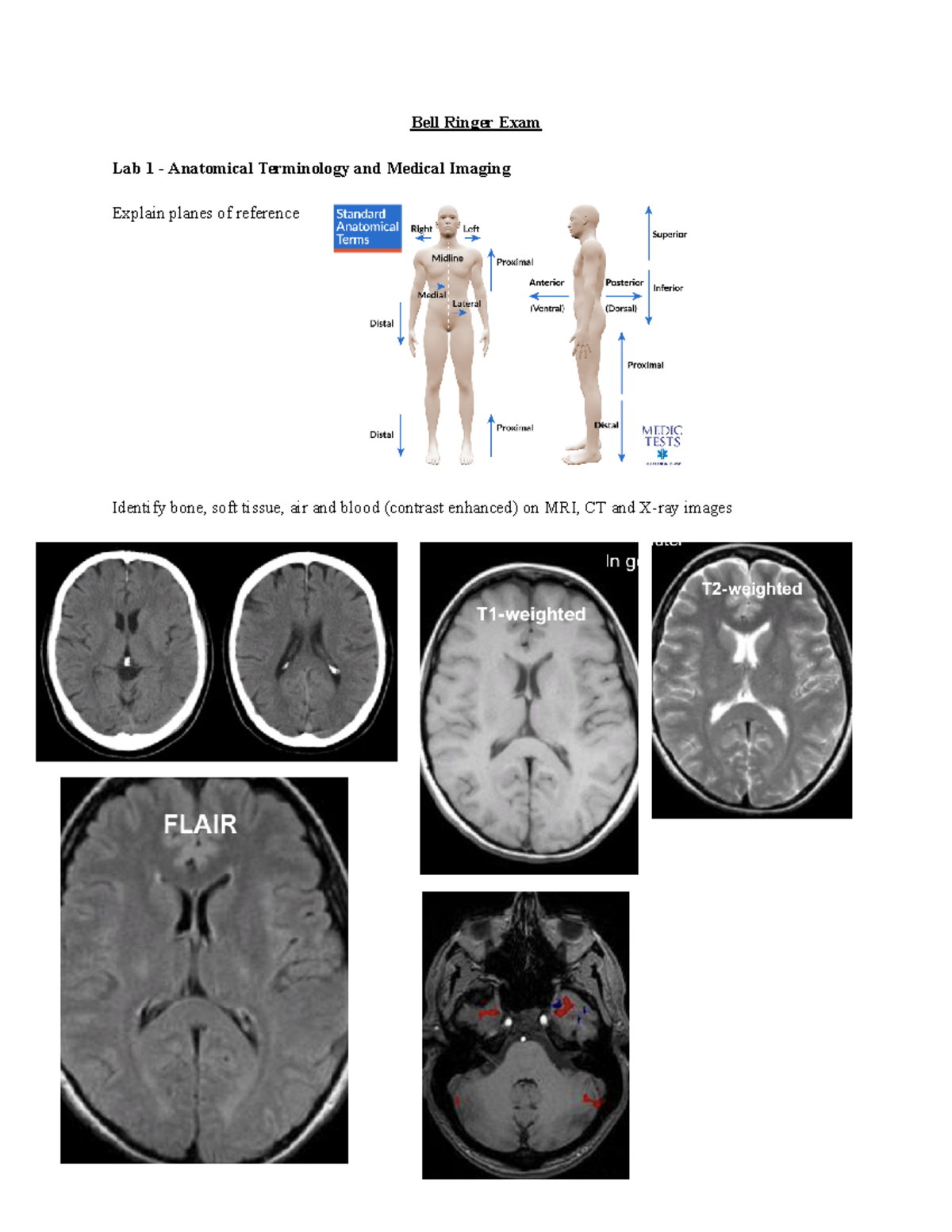 Anatomy Lab Prep: Bell Ringer Exam Review for NS 101 - Studocu
