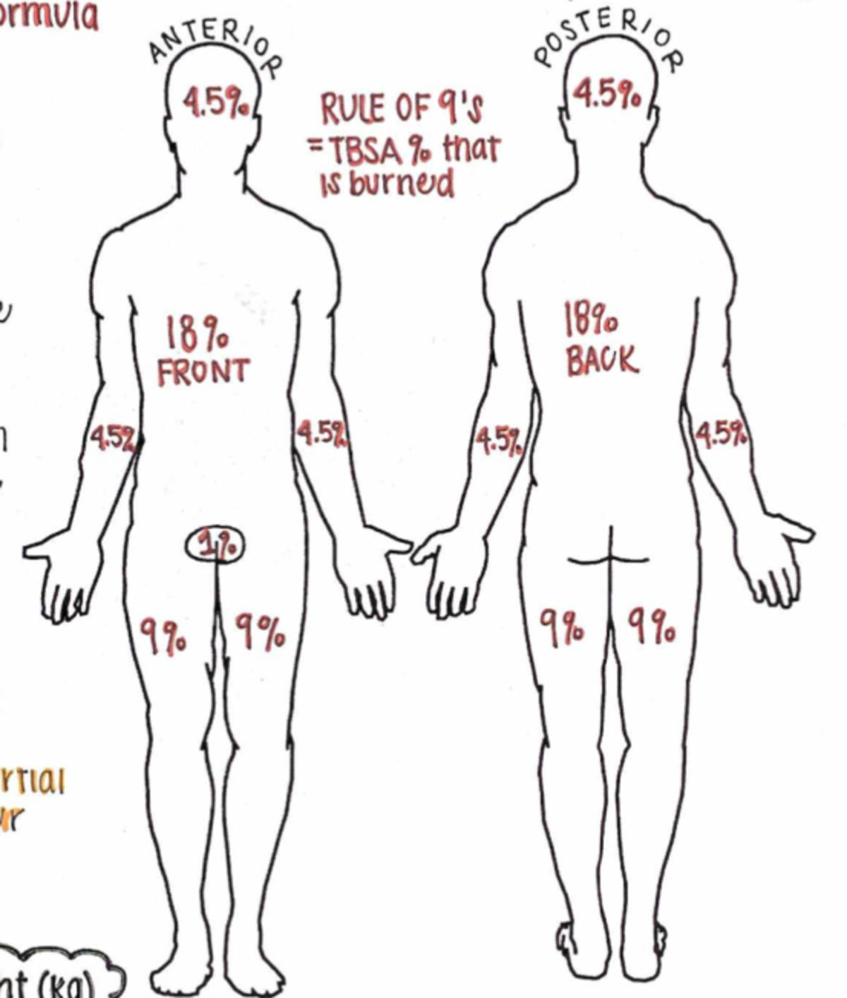 Burn formula - ..... - rmvia ANTERIOR POSTERIOR RULE OF TBSA 90 that IS ...
