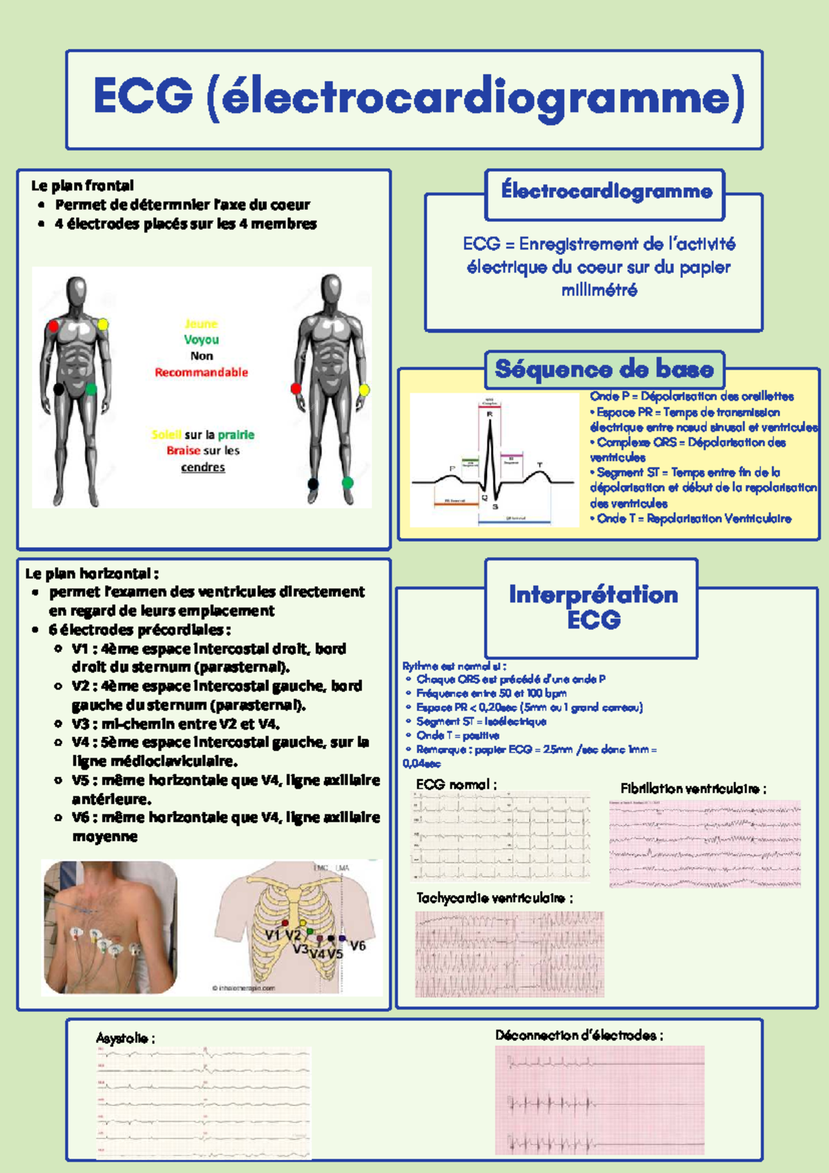 ECG (Electrocardiogram) - Cours Complet sur l'Interprétation et les ...