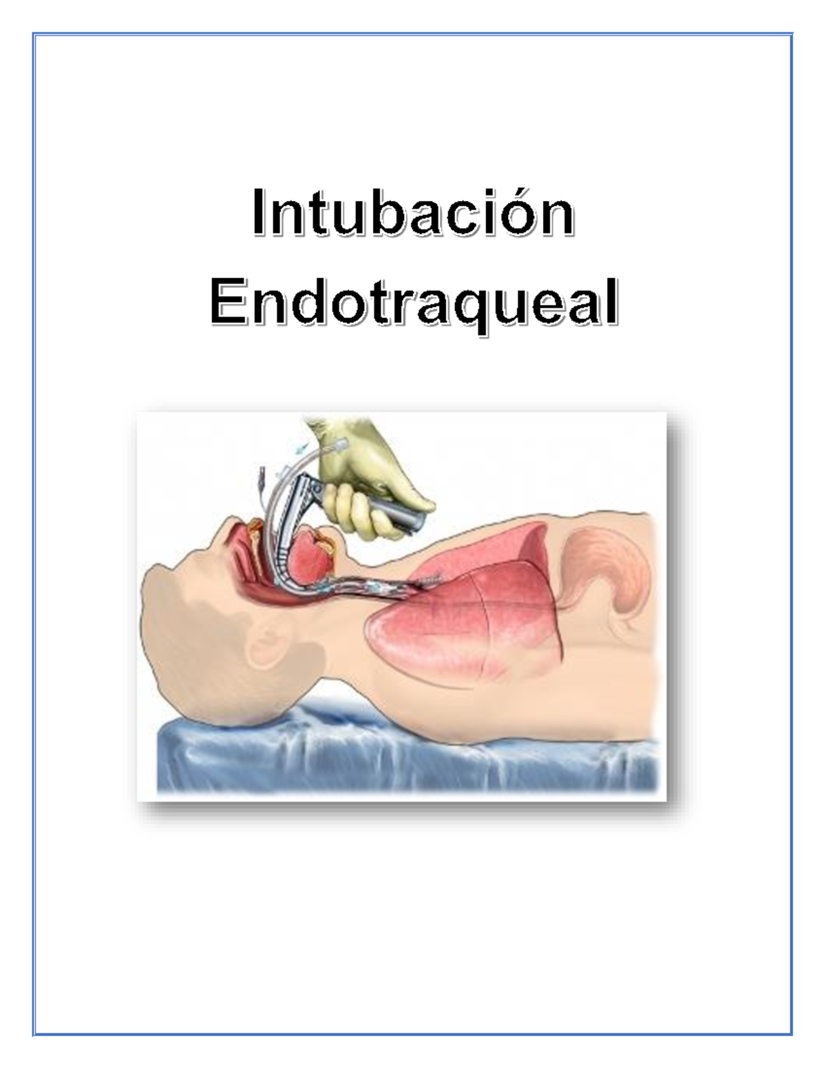 Intubación Endotraqueal en Urgencias Médicas - Enfermería G 6° A - Studocu