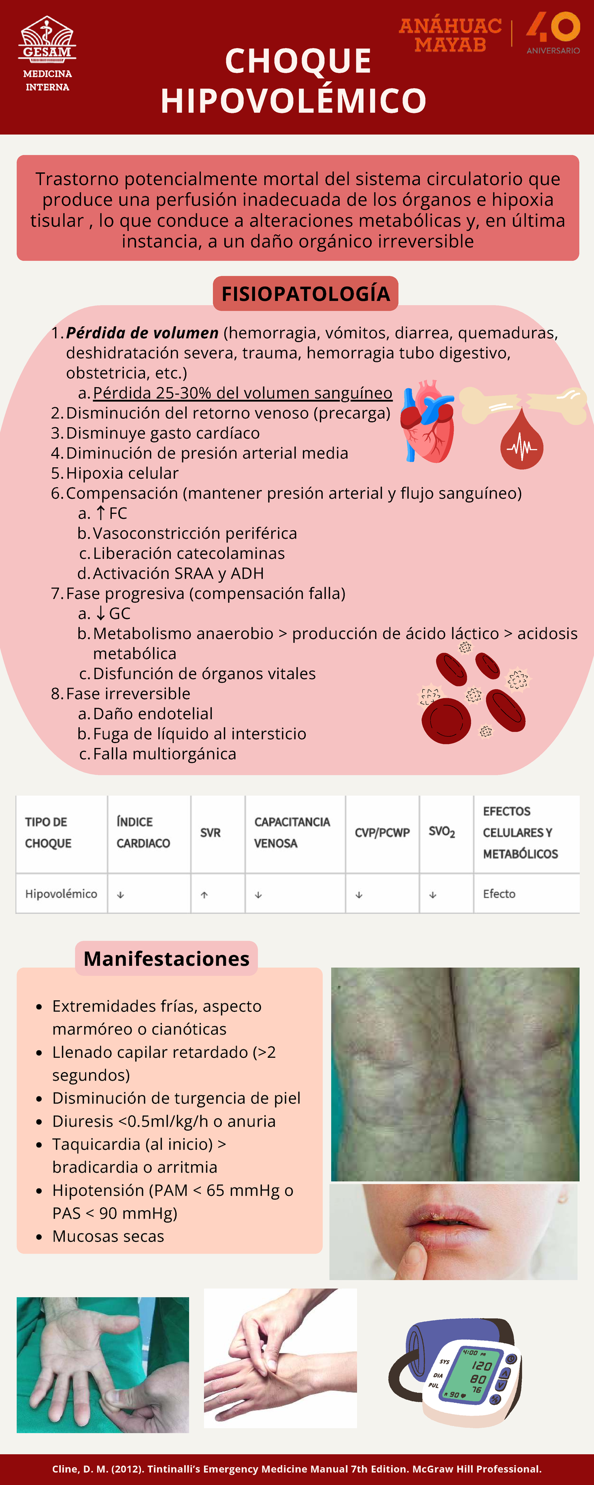 CHOQUE HIPOVOLÉMICO EN MEDICINA INTERNA: FISIOPATOLOGÍA Y ...