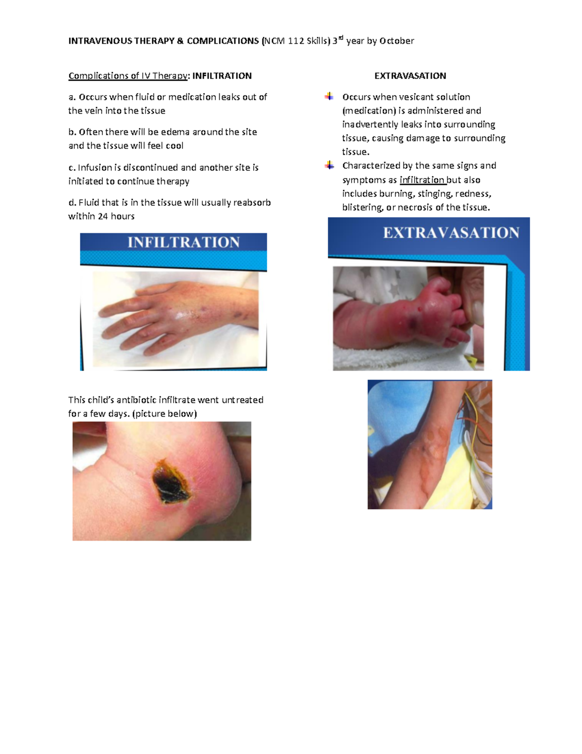 Complications of IV Therapy - INTRAVENOUS THERAPY & COMPLICATIONS (NCM ...