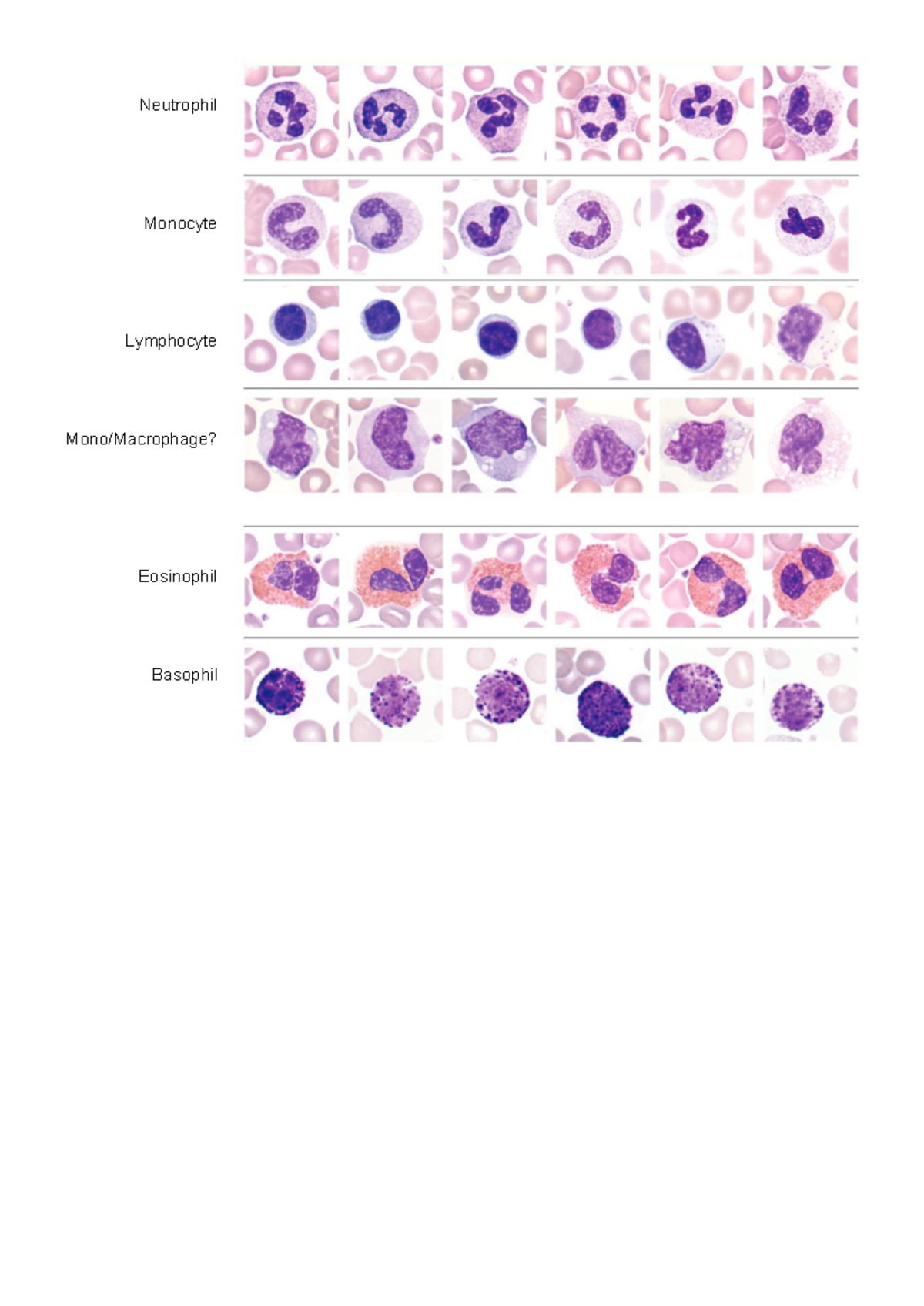 WBC DC - Activity asynchronous laboratory - Anaphy - Neutrophil ...