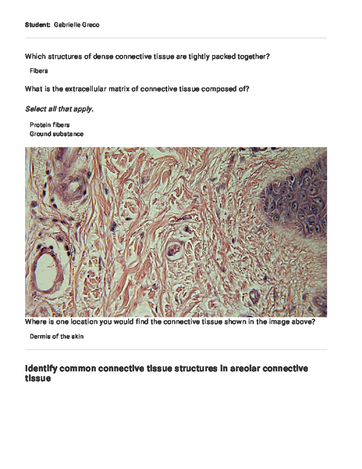 Microscopy Lab - Connective Tissue - Part 3 - Student: Gabrielle Greco ...