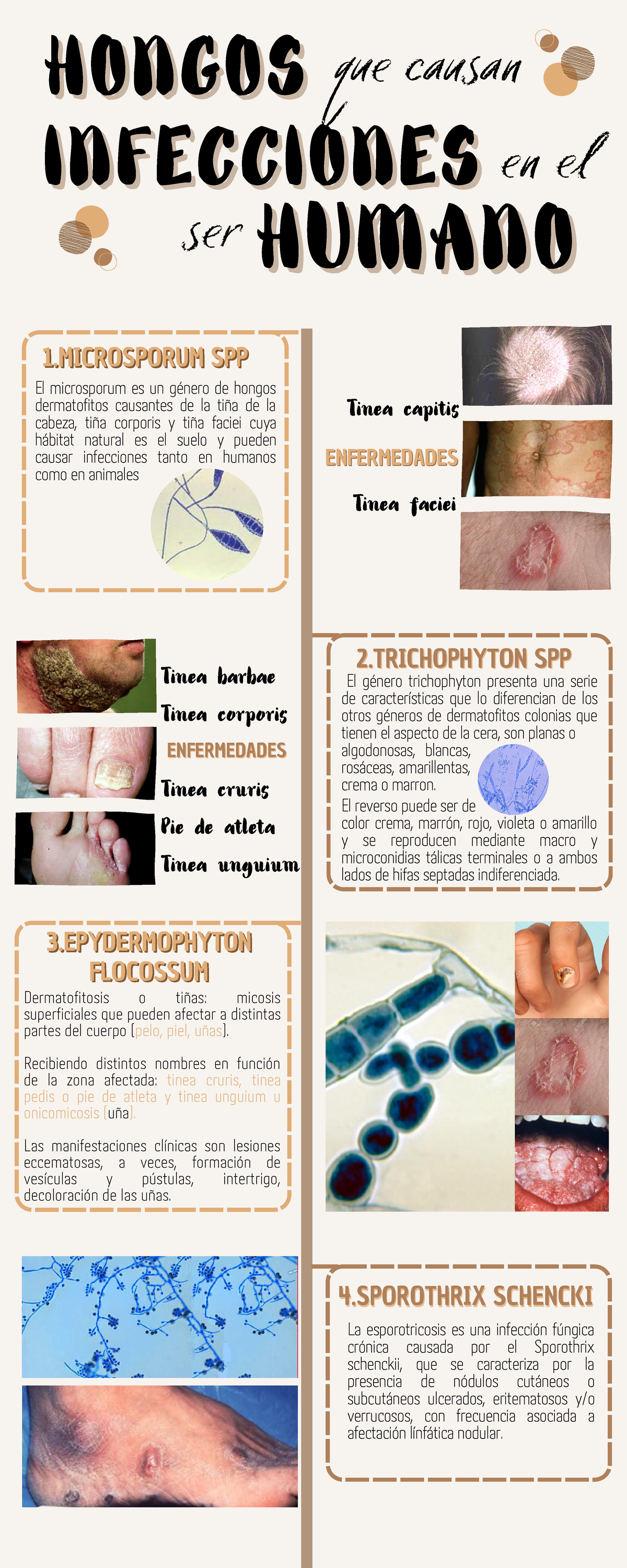 Tipos De Infecciones Por Hongos