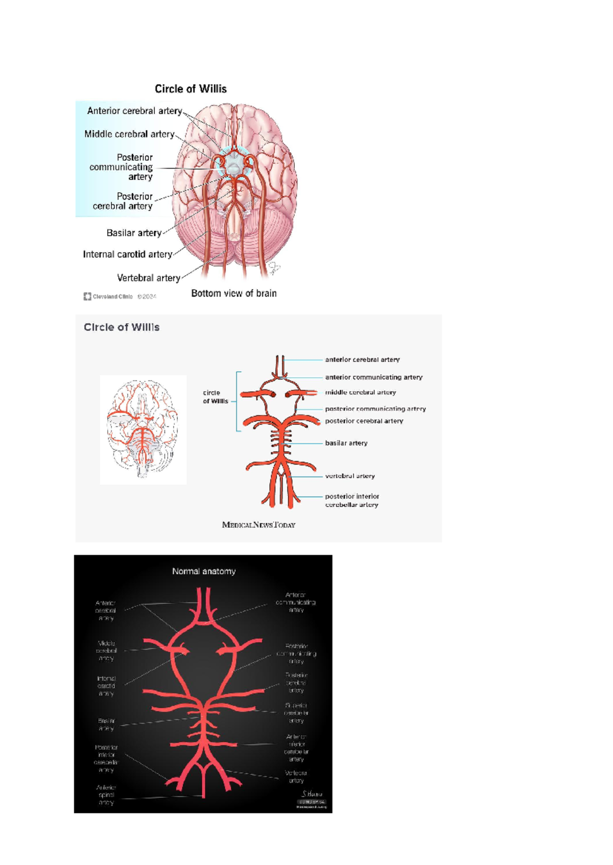 Circle of willis diagrams - Circle of Willis Anterior cerebral artery ...