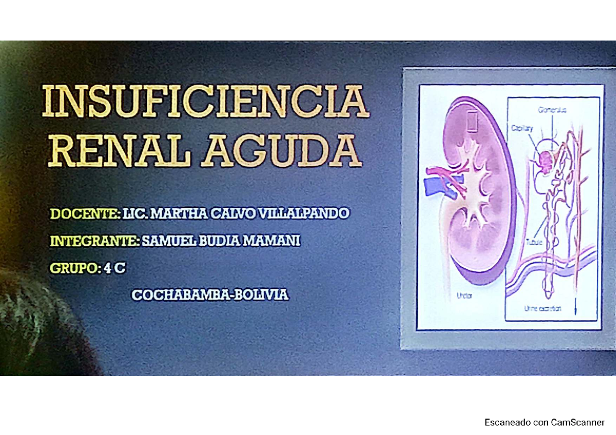 INSF 2: Insuficiencia Renal Aguda - Clasificación y Tratamiento - Studocu