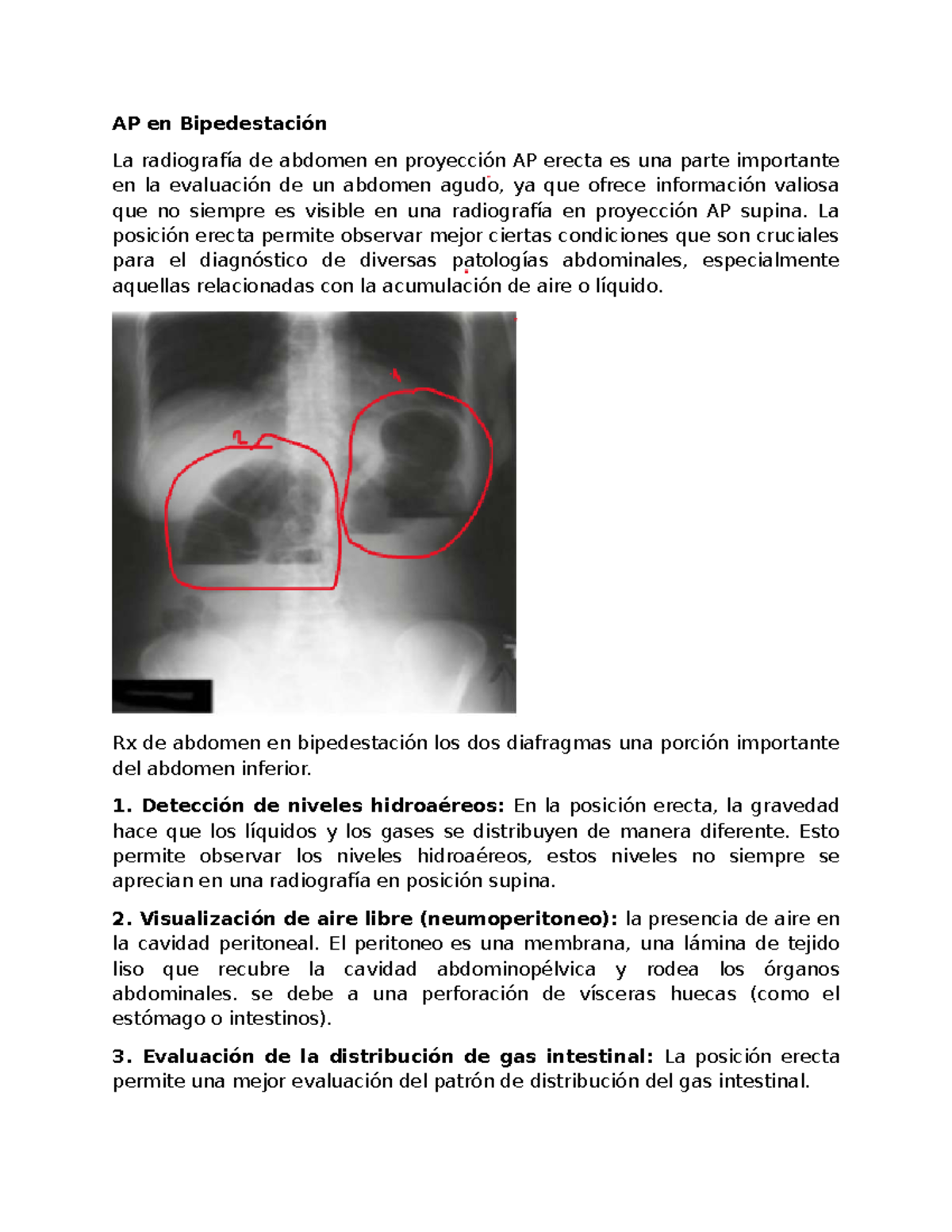 AP - Radiografía de Abdomen en Bipedestación: Evaluación del Abdomen ...