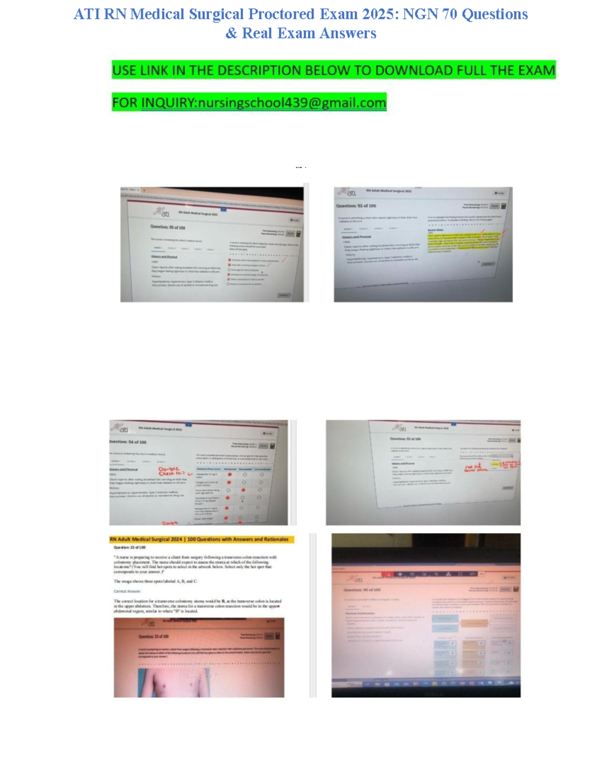 ATI RN Med-Surg Proctored Exam 2025: NGN 70 Qs with Correct Answers ...