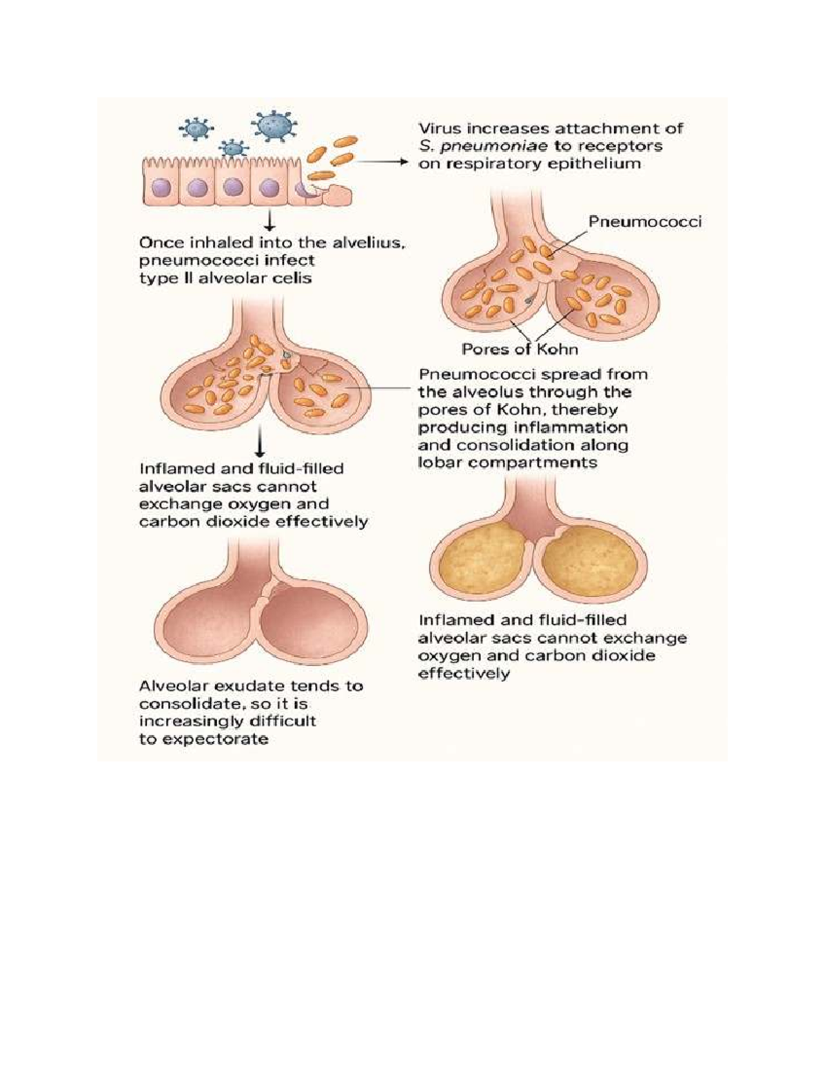 Respiratory Infection Insights: Pneumococci Attachment Mechanisms - Studocu