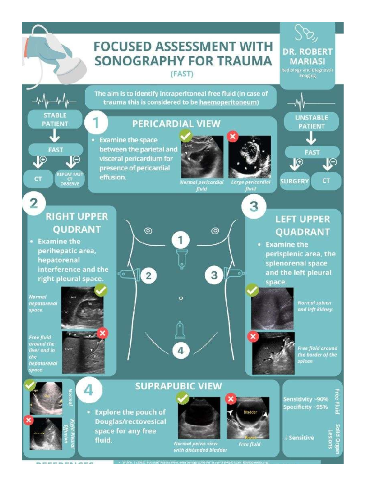 Focused Assessment with Sonography for Trauma (FAST) - Sono Guide - Studocu