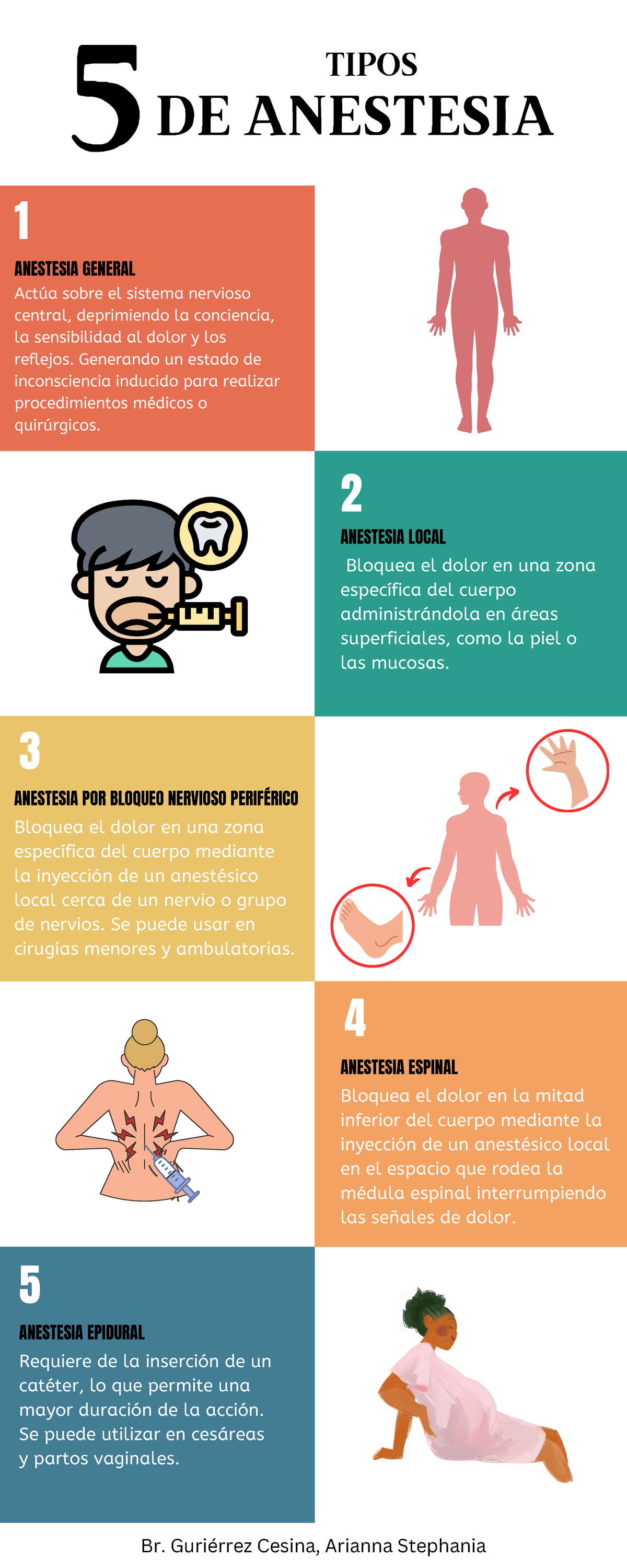 Tipos De Anestesia – Que Son Las Anestesias – CIFK