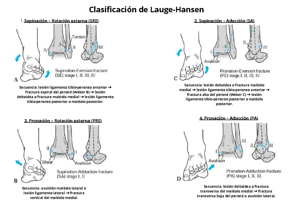 Clasificacion de Lauge-Hansen - Supinación – Rotación externa (SRE) 2 ...