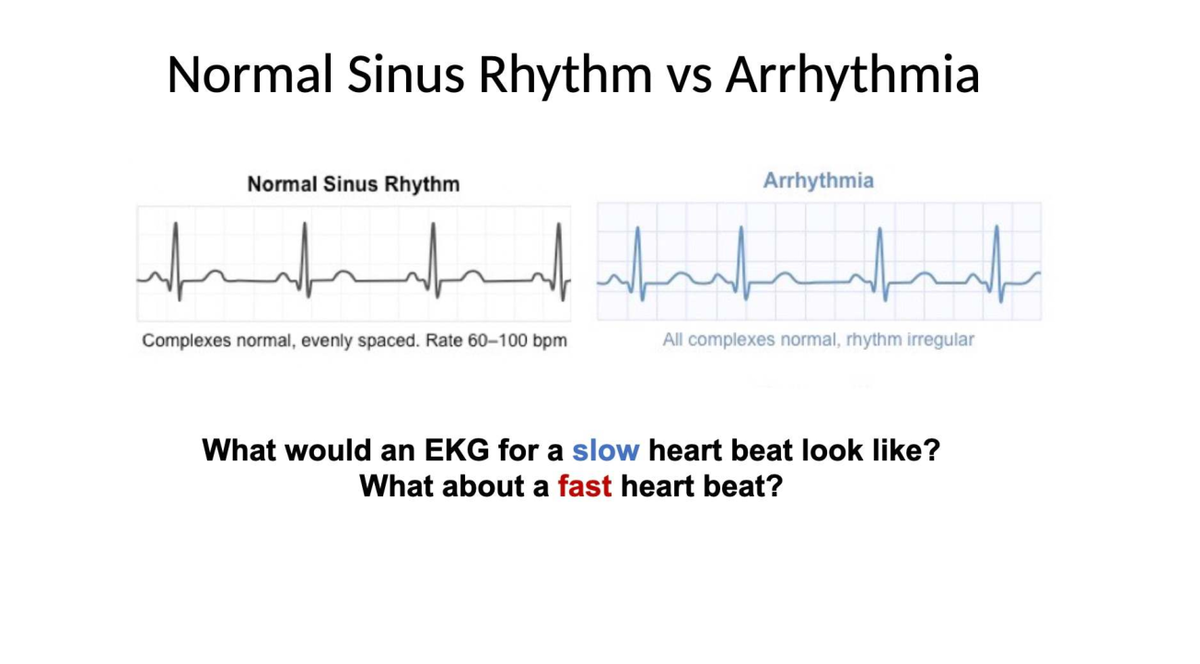 Screenshot 2026-05-05 at 11.15.43 PM - PhySci 5 - Normal Sinus Rhythm ...