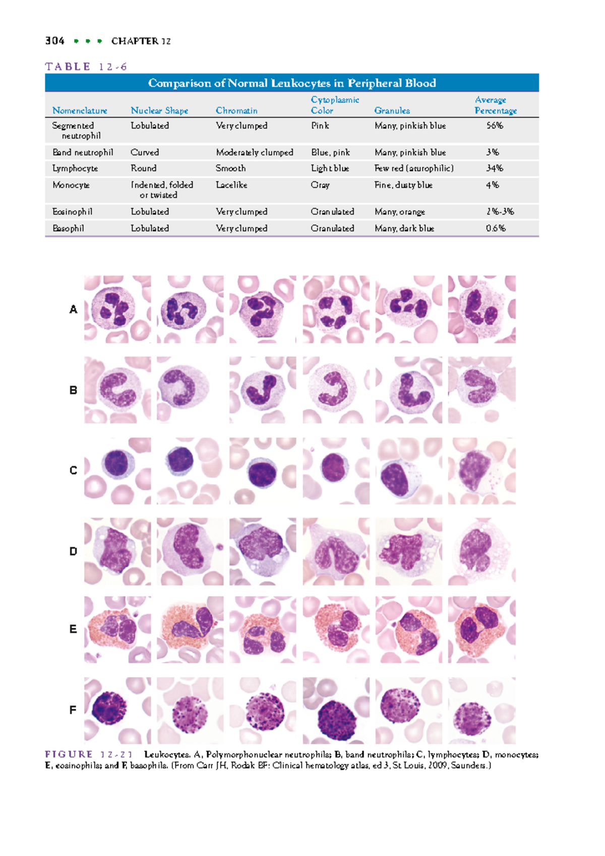 Clinical Laboratory Science (33) - Leukocyte Morphology and Alterations ...
