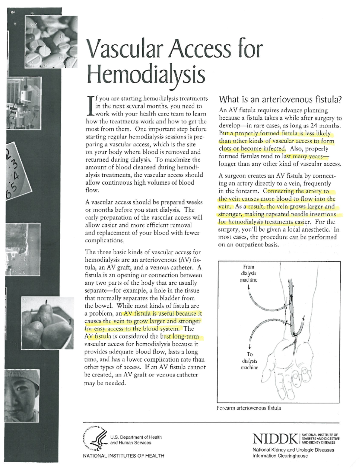 Vascular Access for Hemodialysis: Understanding AV Fistulas and Grafts ...