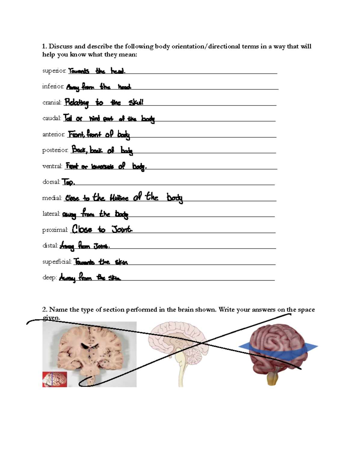 Directional terms and body regions - Discuss and describe the following ...