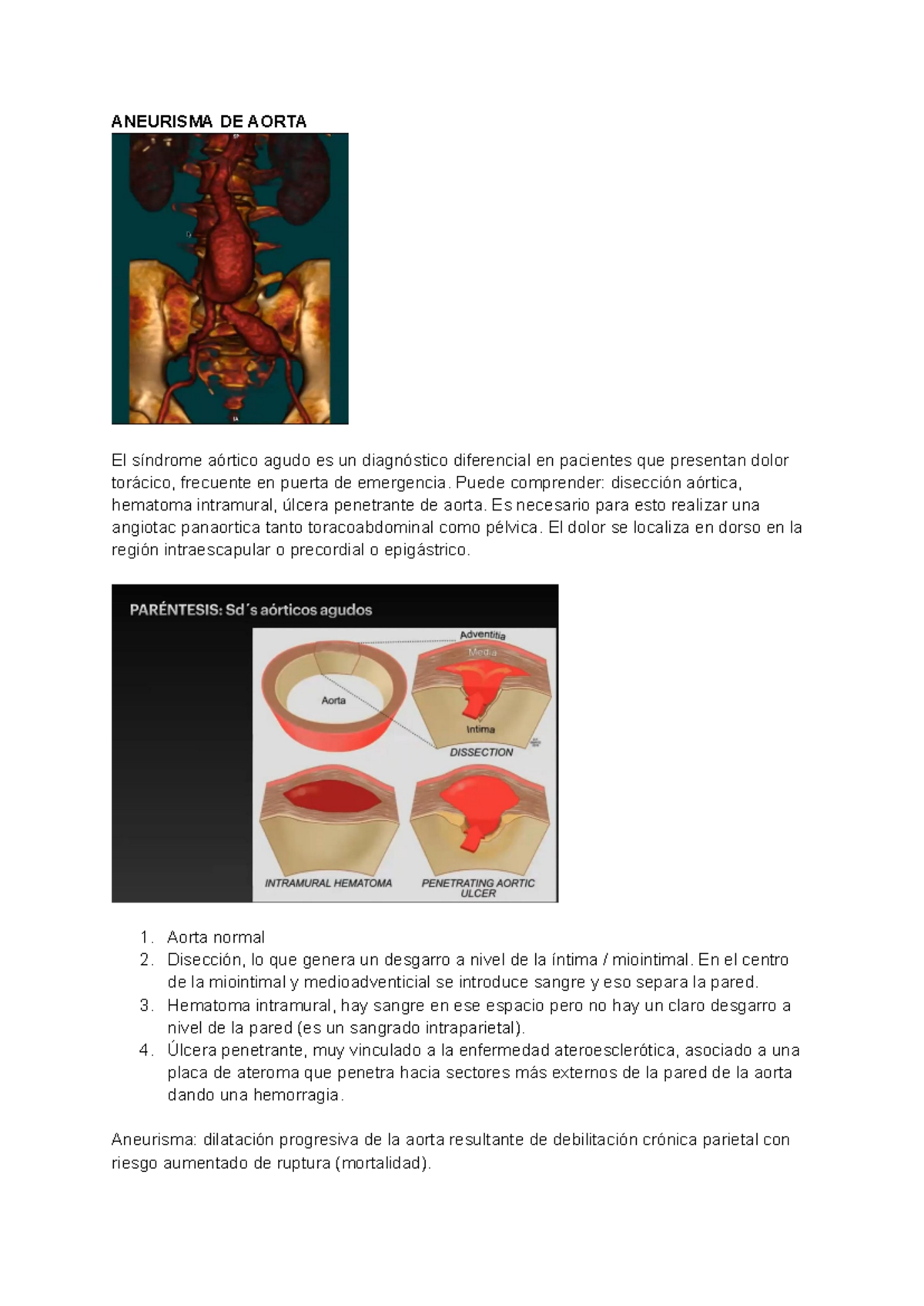 Aneurisma de Aorta: Resumen y Tratamiento - Medicina Clásica - Studocu