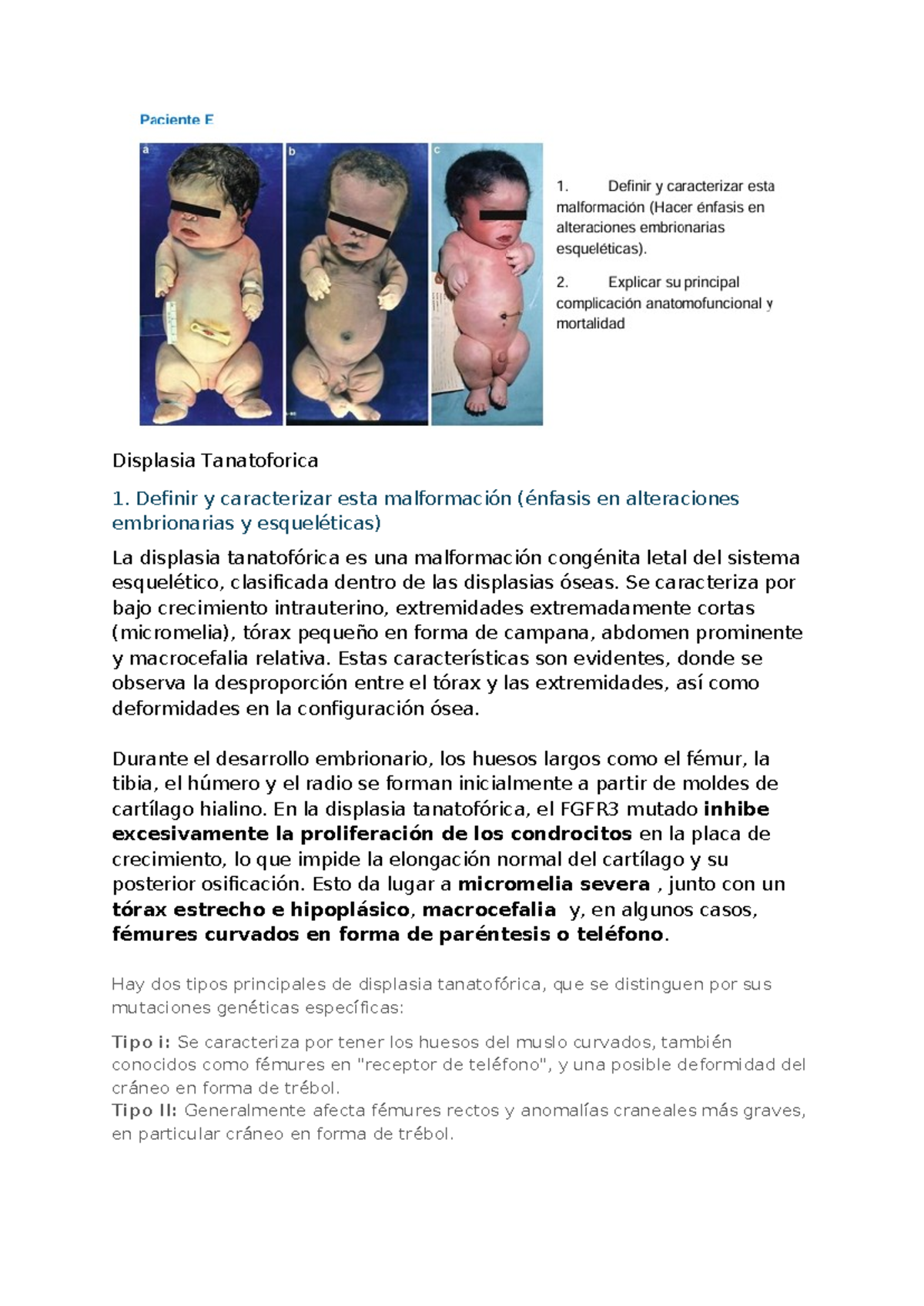 caso-e-displasia-tanatof-rica-caracter-sticas-y-complicaciones-studocu