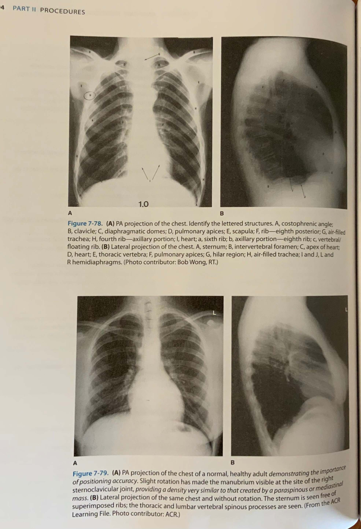 Comprehensive Study Guide for XYZ 101 Midterm Exam: Chest Projections ...