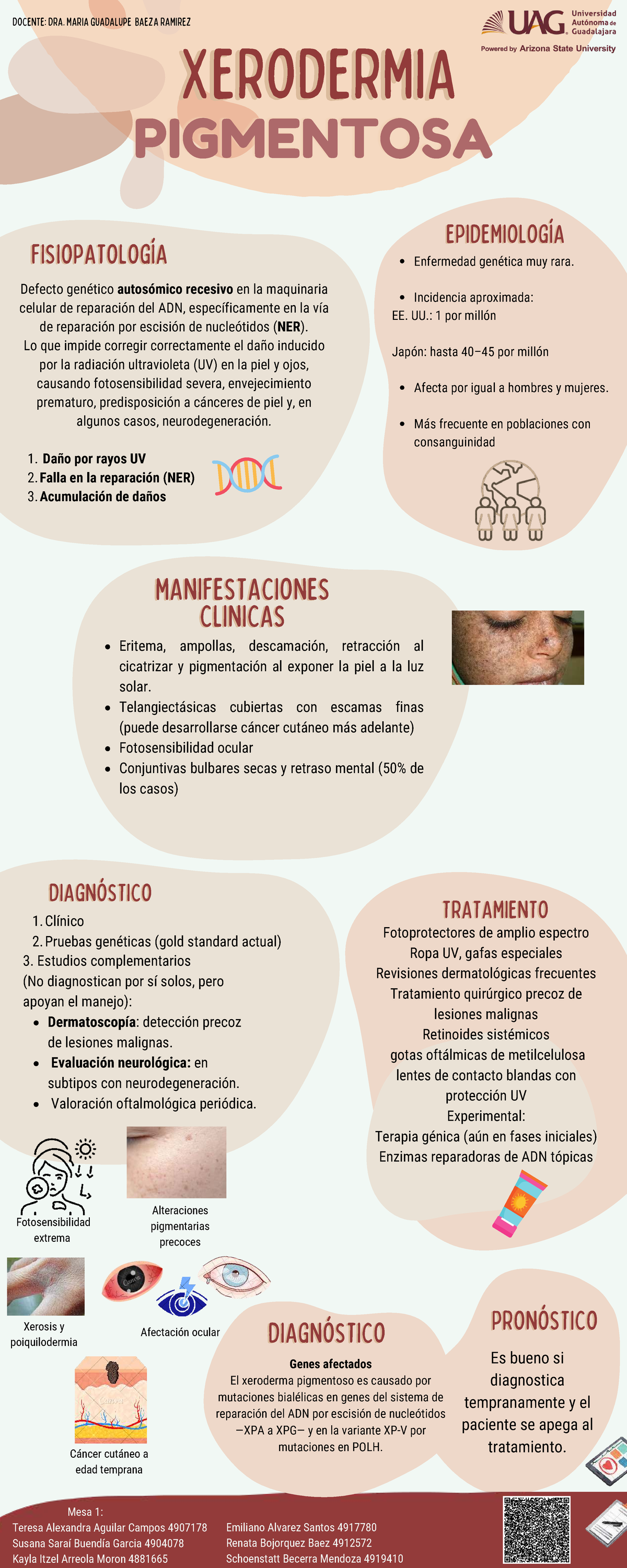Infografía sobre Xeroderma Pigmentoso: Epidemiología y Tratamiento ...