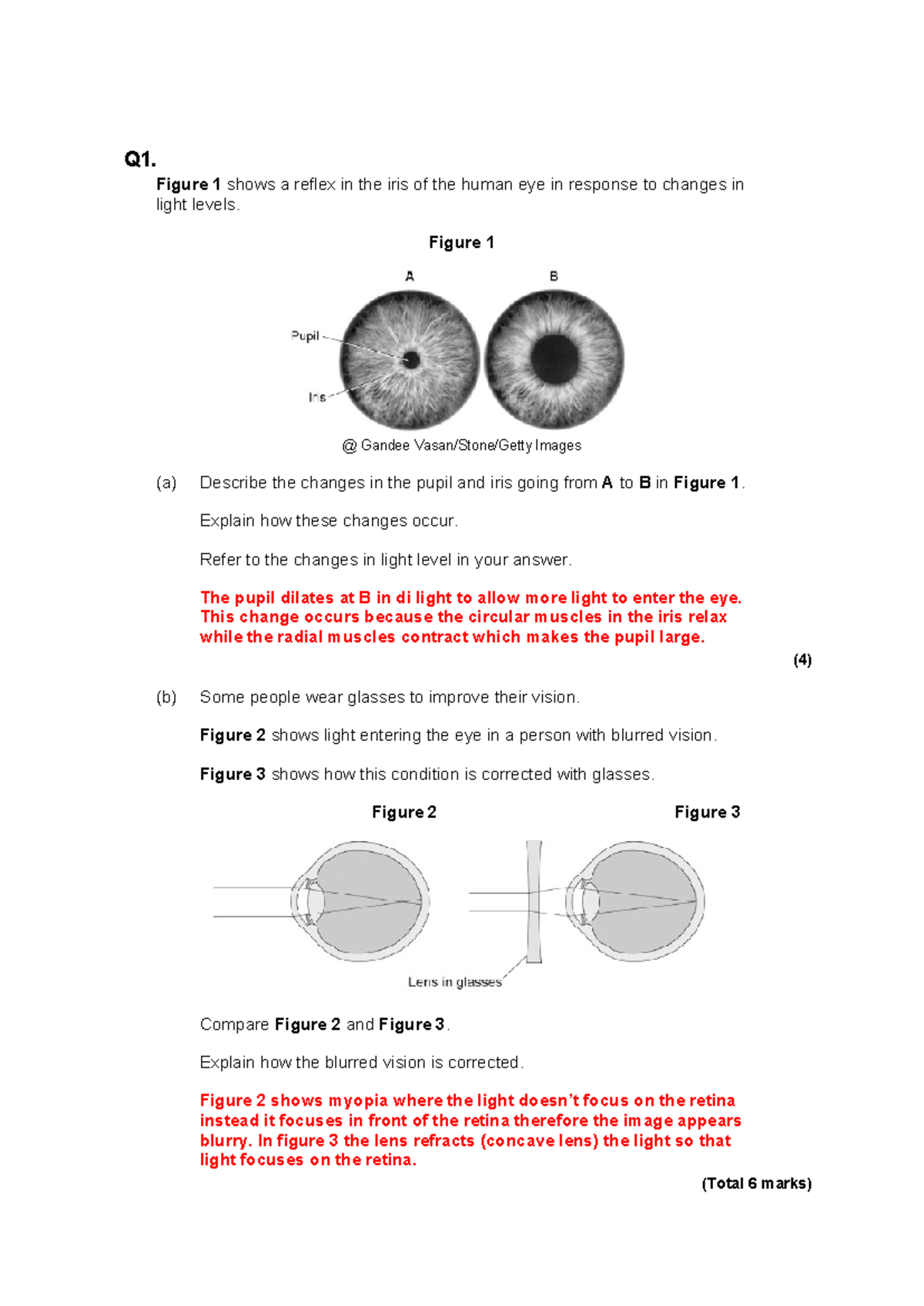 AQA Biology GCSE: Past Exam Questions on the Eye Topic - Studocu