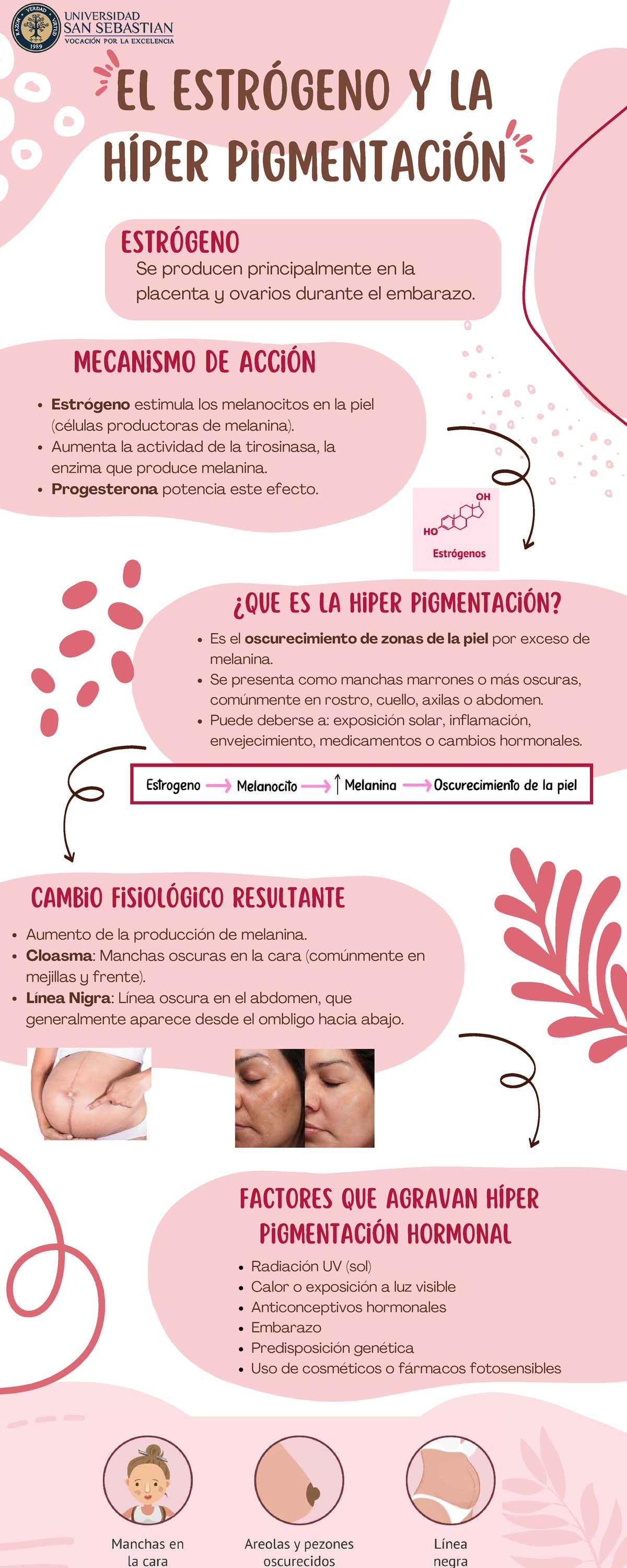 Infografía sobre Hiperpigmentación en el Embarazo (Estrógeno) - Studocu
