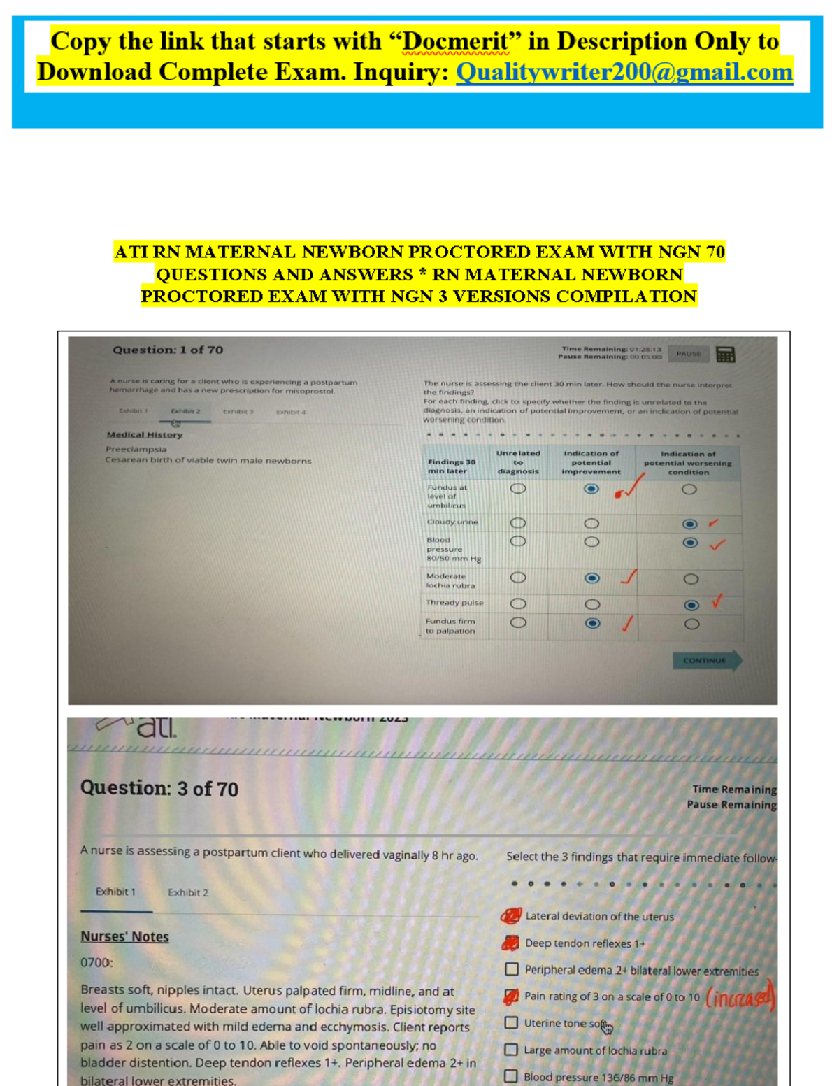 New 2024 ATI RN Maternal Newborn Proctored Exam With NGN All 70 ...