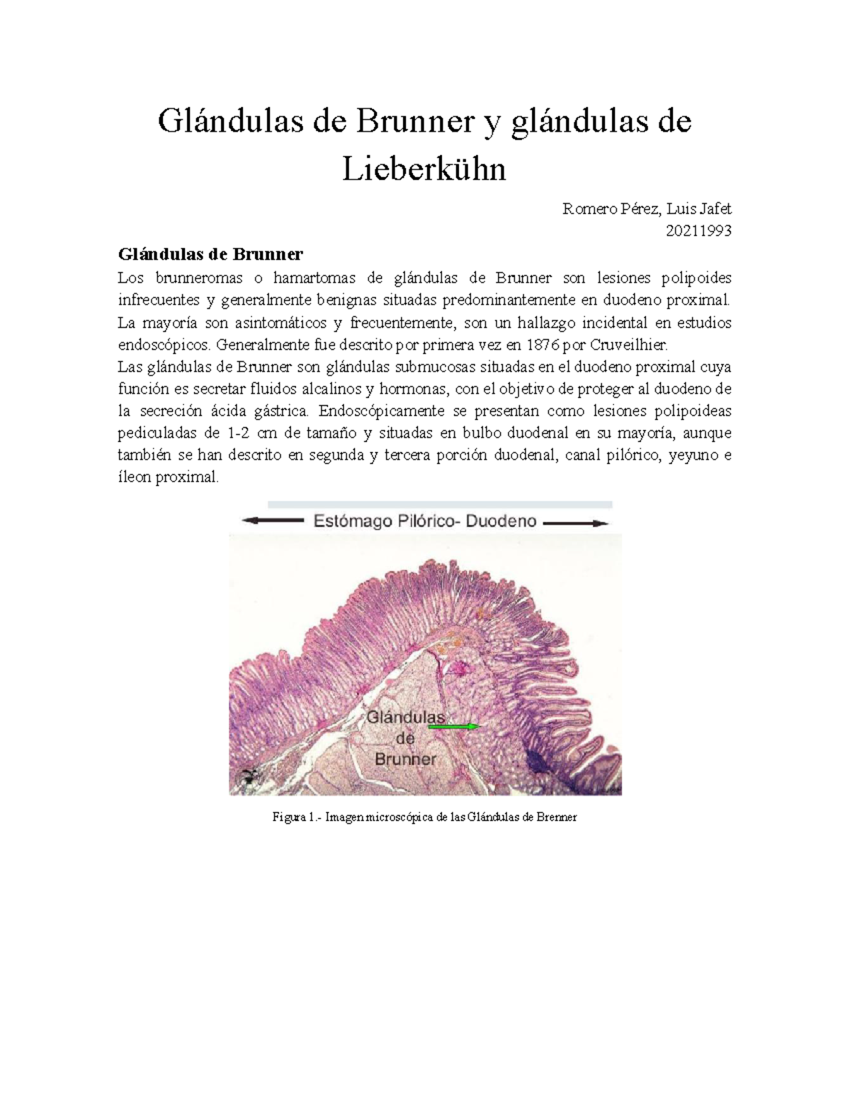 U1 Glándulas de Brunner y Lieberkühn: Características y Funciones - Studocu