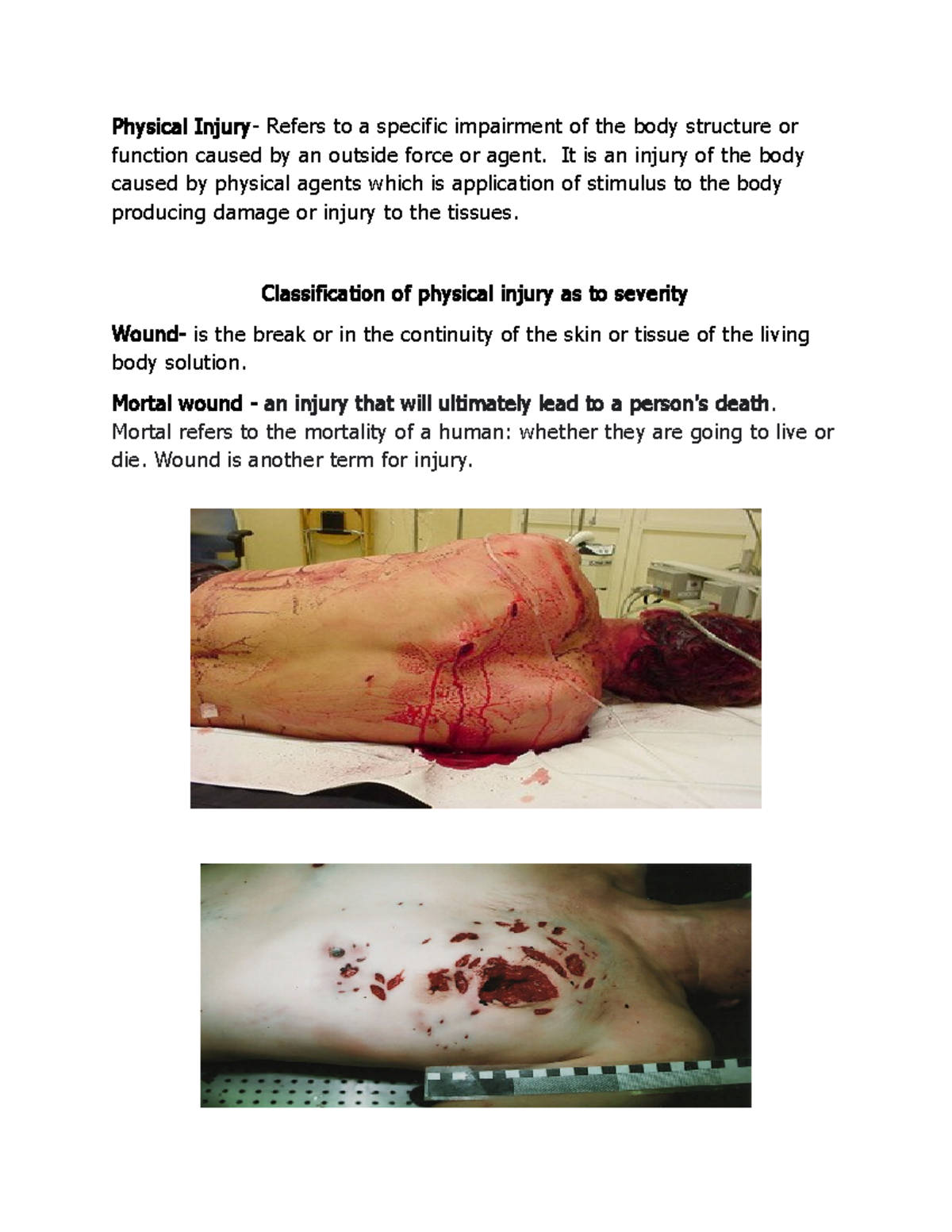 CDI 2: Notes on Physical Injury and Its Role in Legal Medicine - Studocu