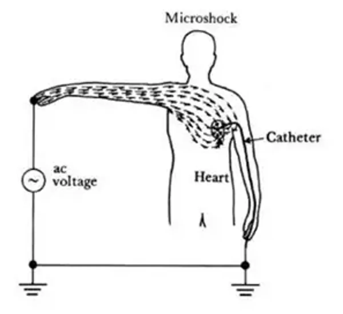Macroshock and Microshock Definitions in Electrical Safety - Studocu