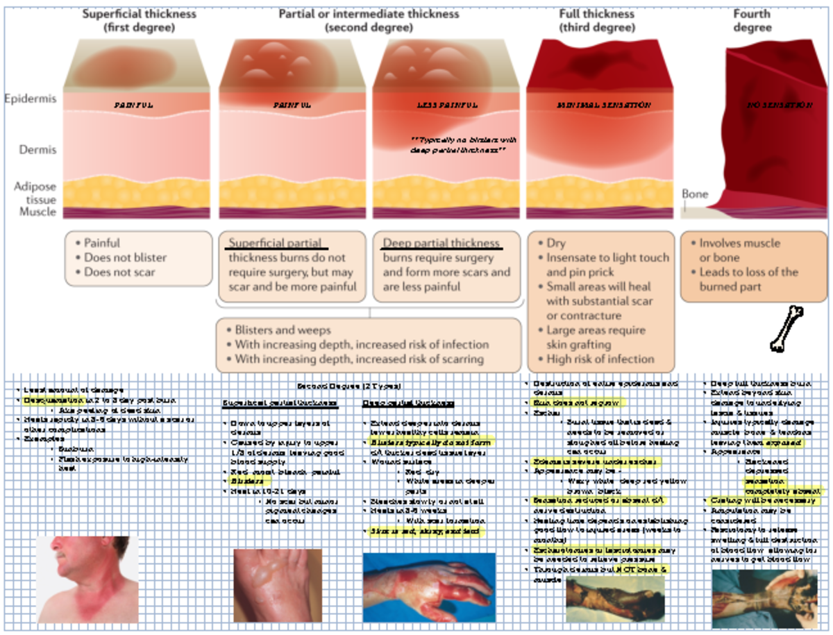 Comprehensive Study on Burns: Types, Phases, and Management Techniques ...