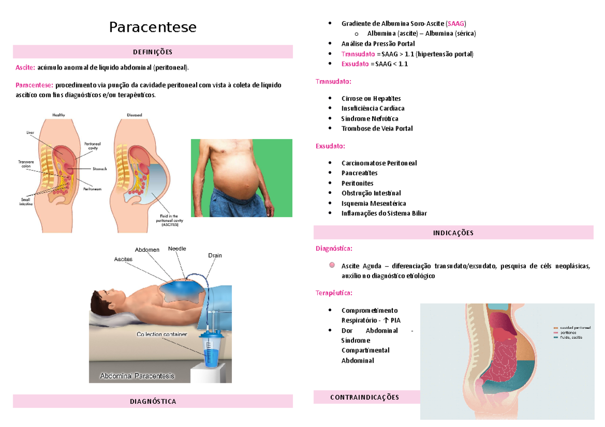 Paracentese - Paracentese DEFINIÇÕES Ascite: acúmulo anormal de líquido ...