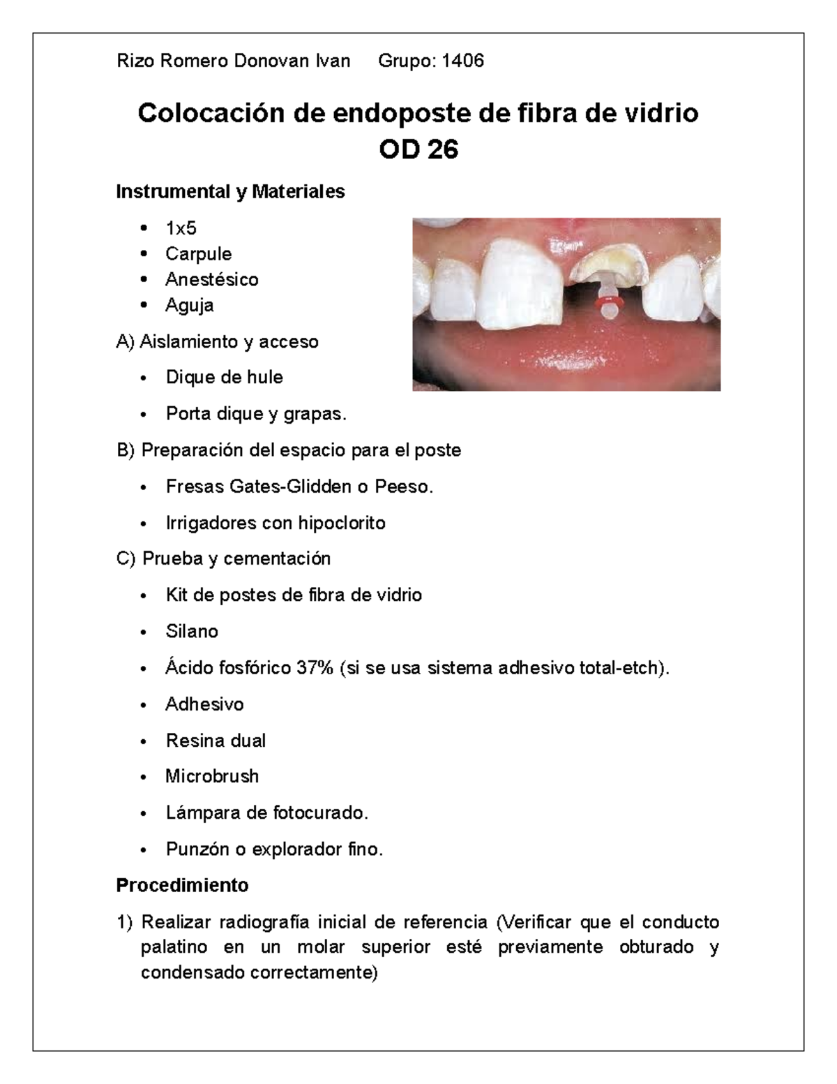 Colocación de Endoposte de Fibra de Vidrio - Diseño Instruccional 1406 ...